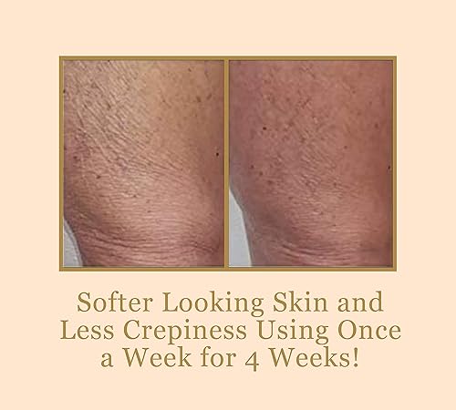 Miniatura 3 de DIAMONDBUFF Microderm - Herramienta de exfoliación  Microdermoabrasión profesional de cristal de diamante para una piel joven brillante  suaviza la