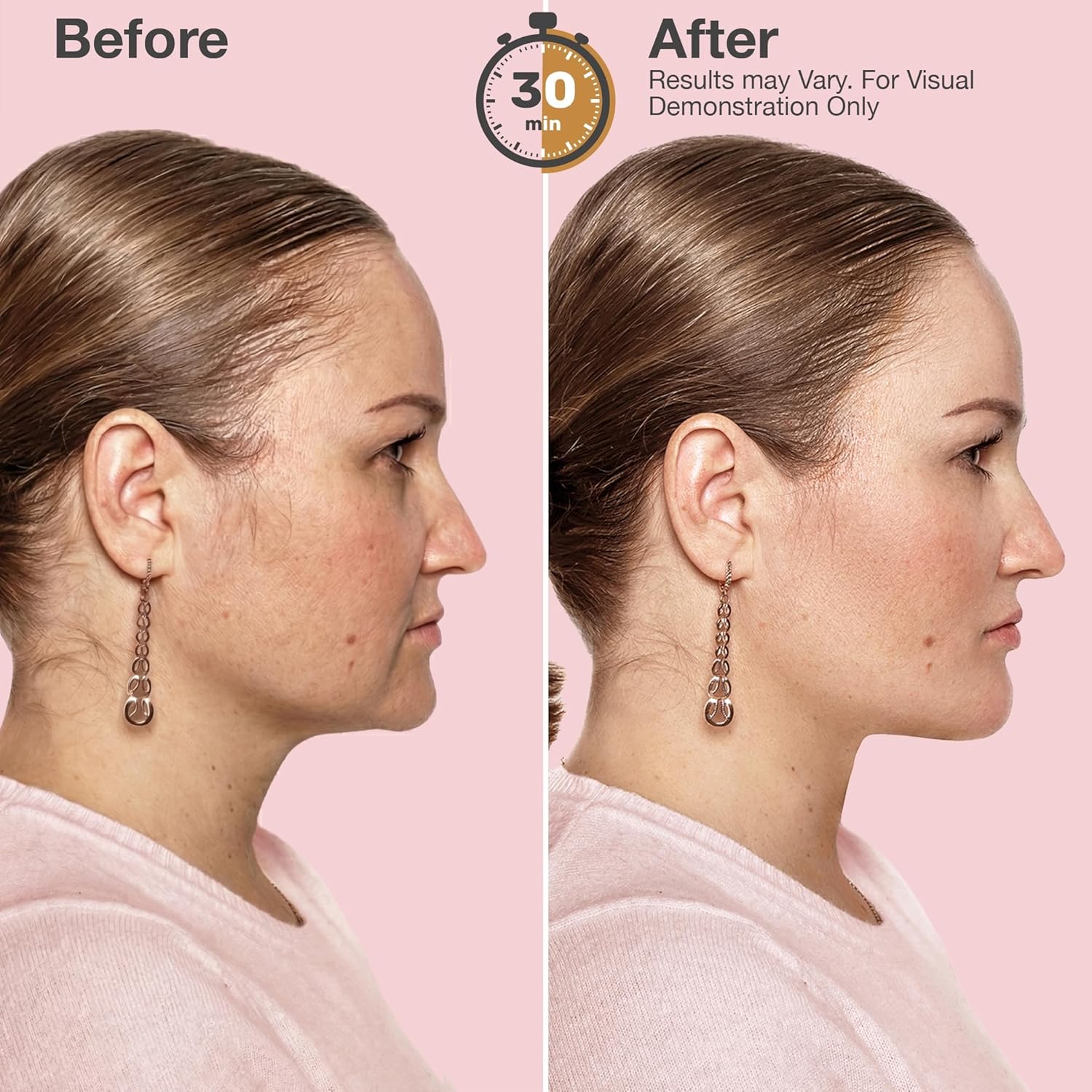 V Line Lifting Neck & Chin Mask – Jawline Shaper & Double Chin Reducer – Face Lift & Skin Tightening – Retinol, Collagen, Hyaluronic Acid & Aloe Vera – Anti-Aging Neck Firming Mask – 5 Pack - Image 4