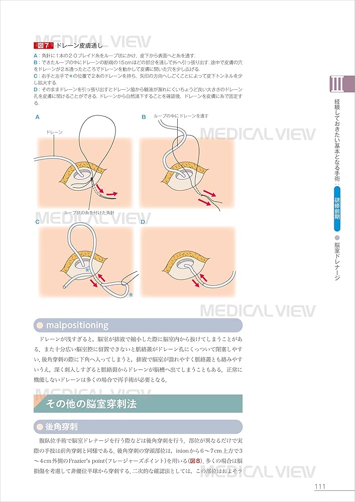 脳神経外科 ザ・ベーシック メジカルビュー社｜脳神経外科｜脳神経外科 ザ・ベーシック