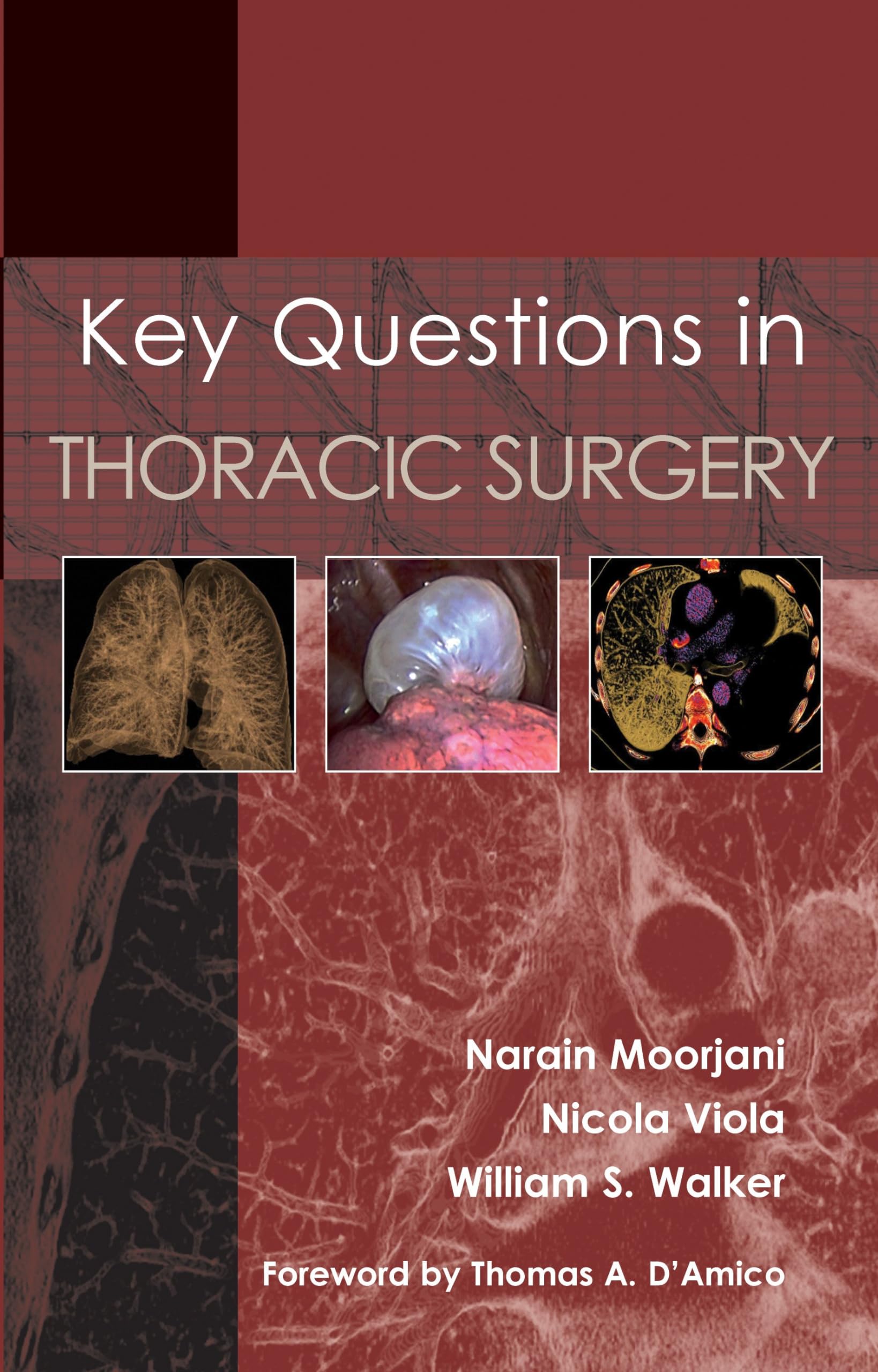 Key Questions in Thoracic Surgery by Narain Moorjani, William S. Walker and ...