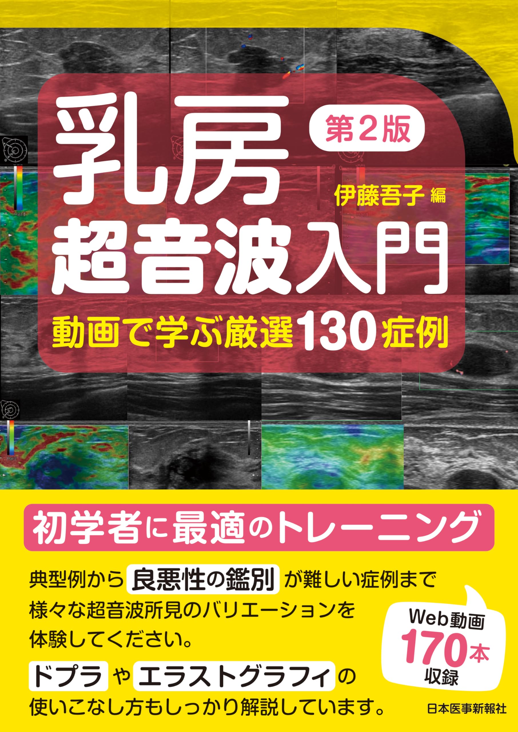 乳房超音波入門 第2版〈動画で学ぶ厳選130症例〉【電子版付】 | 伊藤