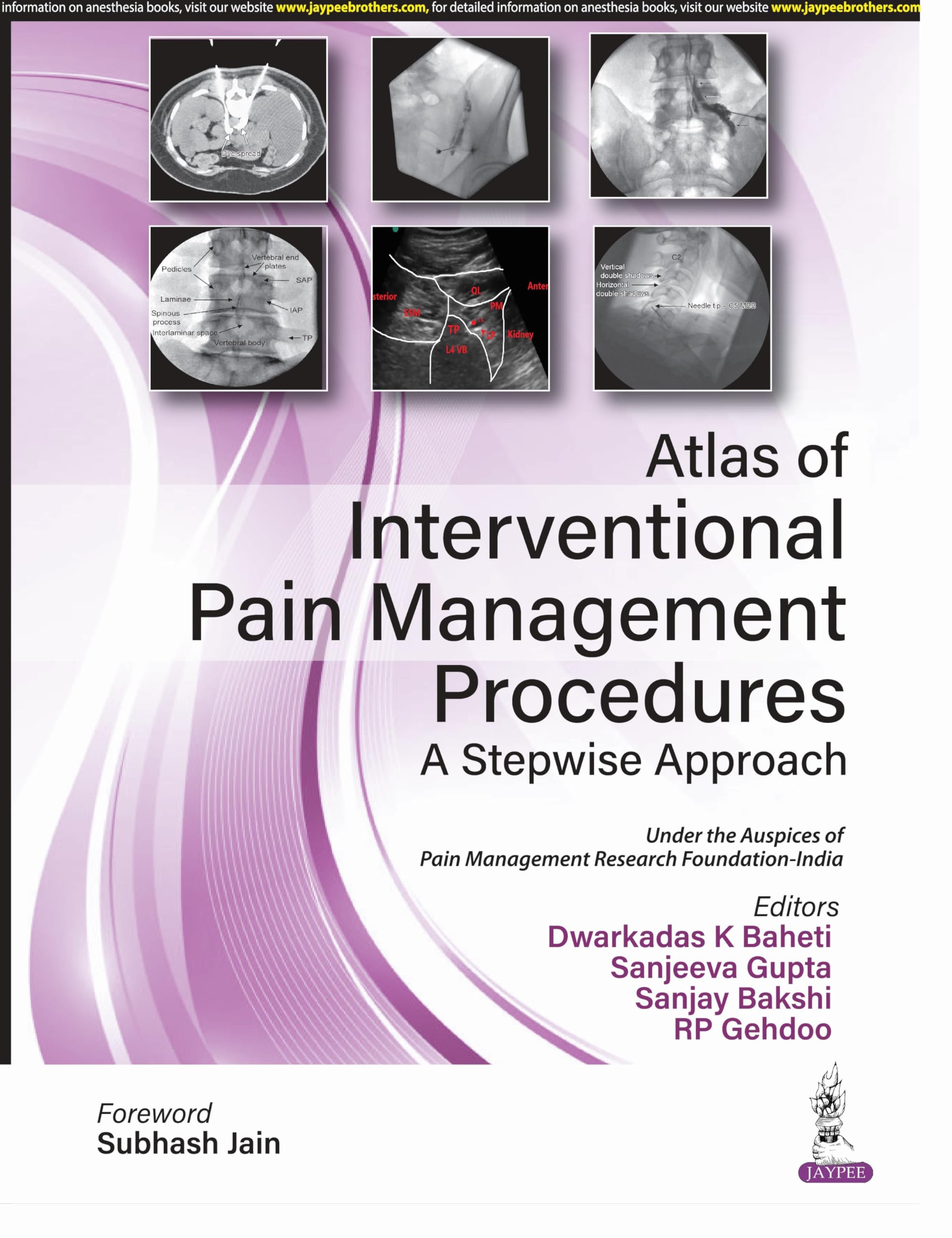 Atlas of Interventional Pain Management Procedures: A Stepwise Approach (English Edition)