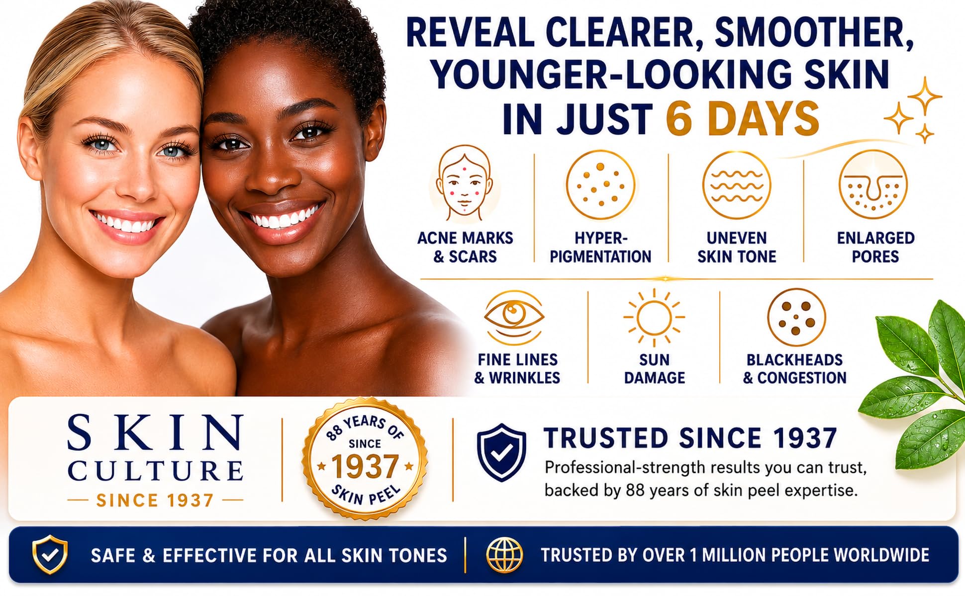Skin Culture Juego de 5 tarros de tratamiento Skin Peel 4000 | Utilizado por miles de hombres y mujeres desde 1937 | Se deshace de cicatrices de acné, manchas, poros grandes, líneas finas, daños por