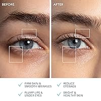 Vista 5 de FOREO BEAR 2 ojos y labios - Microcurrent Line Smoothing Instant Face Lift - Dispositivo de cuidado de ojos - Lifting de cejas - Tratamiento