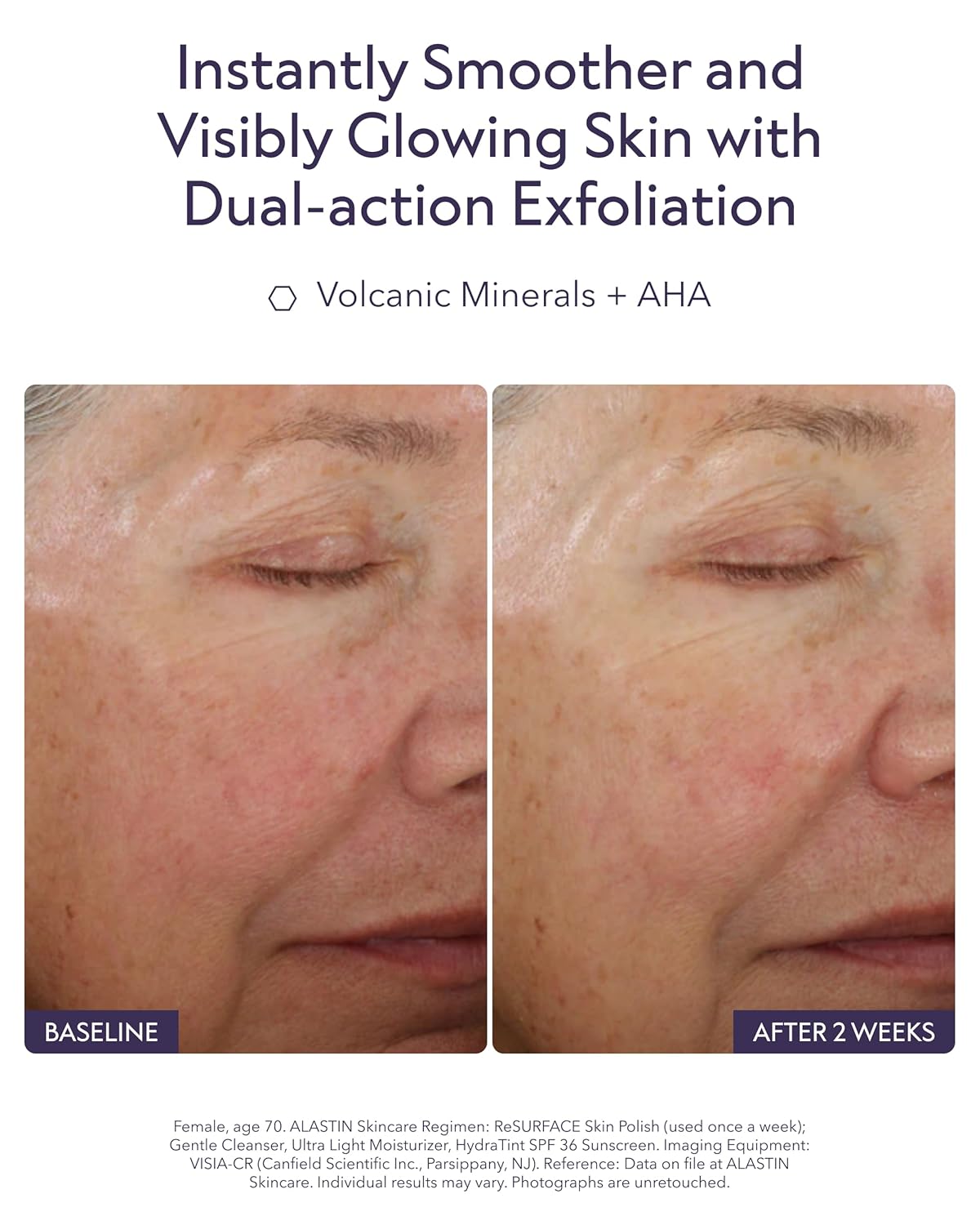 ALASTIN Skincare ReSURFACE Exfoliating Skin Polish (2.3 oz) | Face Scrub For Softer, Smoother Skin | With Glycolic Acid