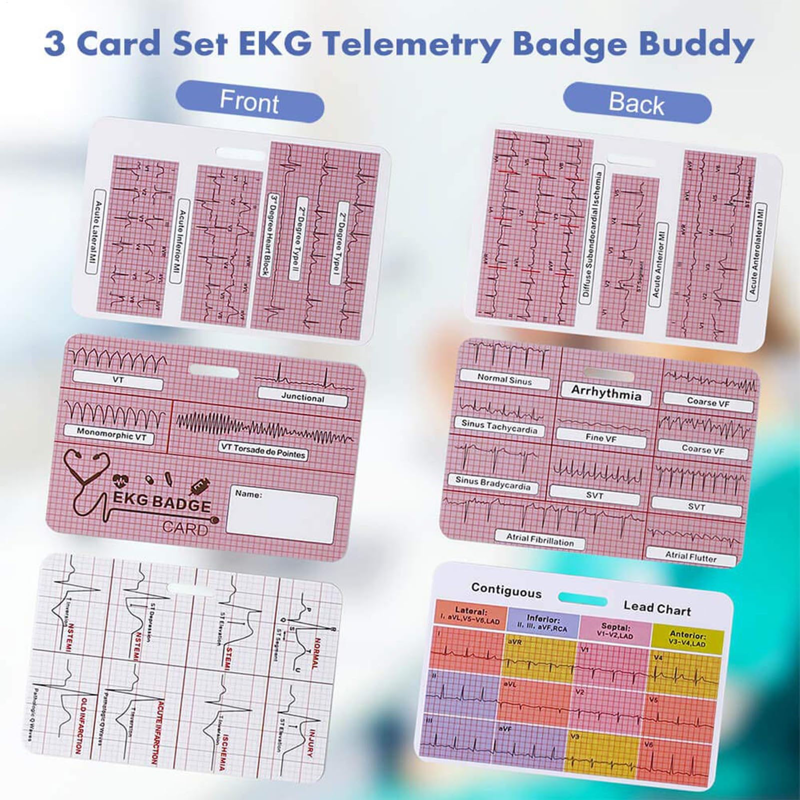 Scheda ECG – badge di riferimento, di riferimento ECG, 3 pezzi, set di carte mediche, ideale per studenti di medicina e infermieristica, paramedici e cliniche di telemetria