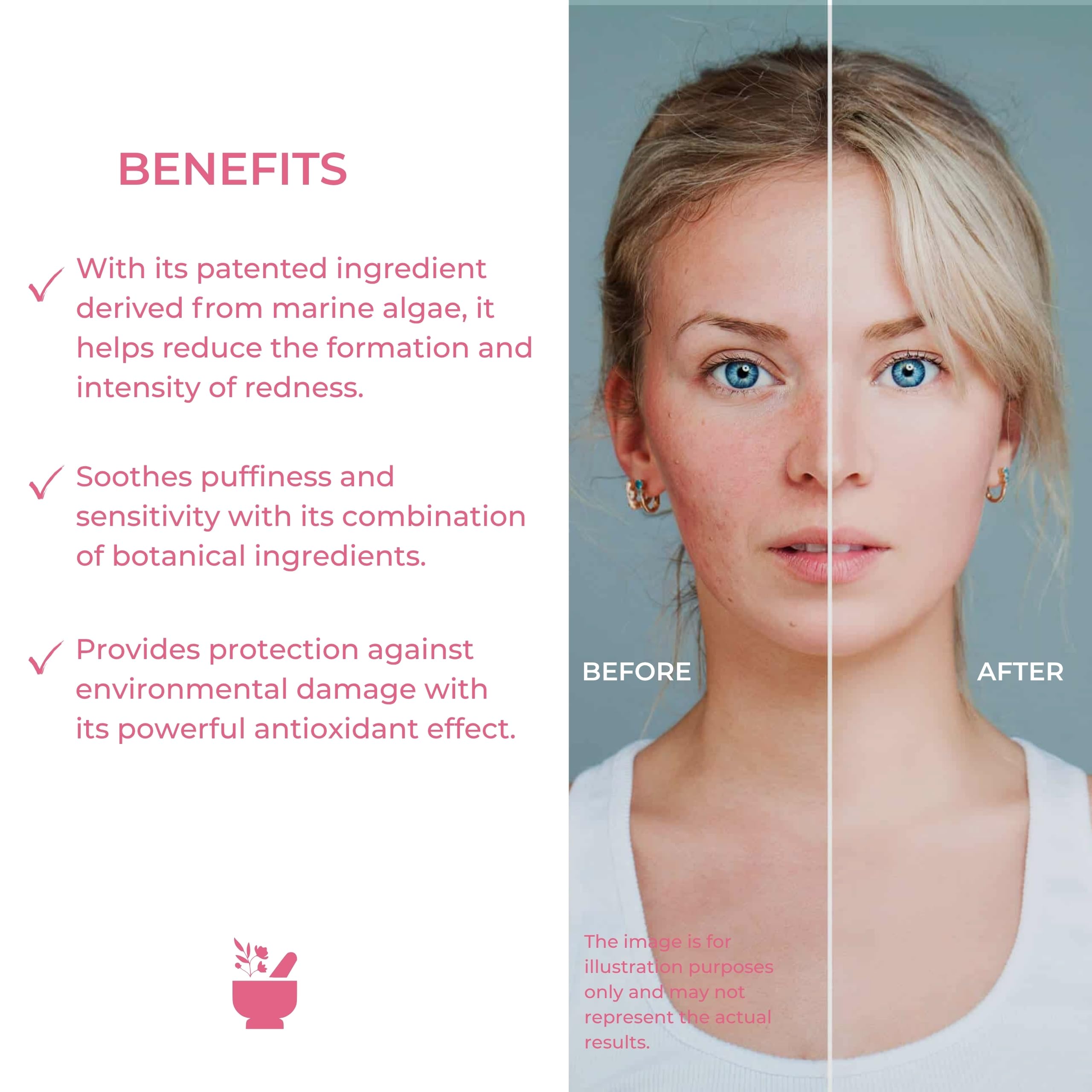 Cosmed Hassas Ciltler İçin Kızarıklık Karşıtı Krem - Anti-Redness Repair Cream - 40 ml