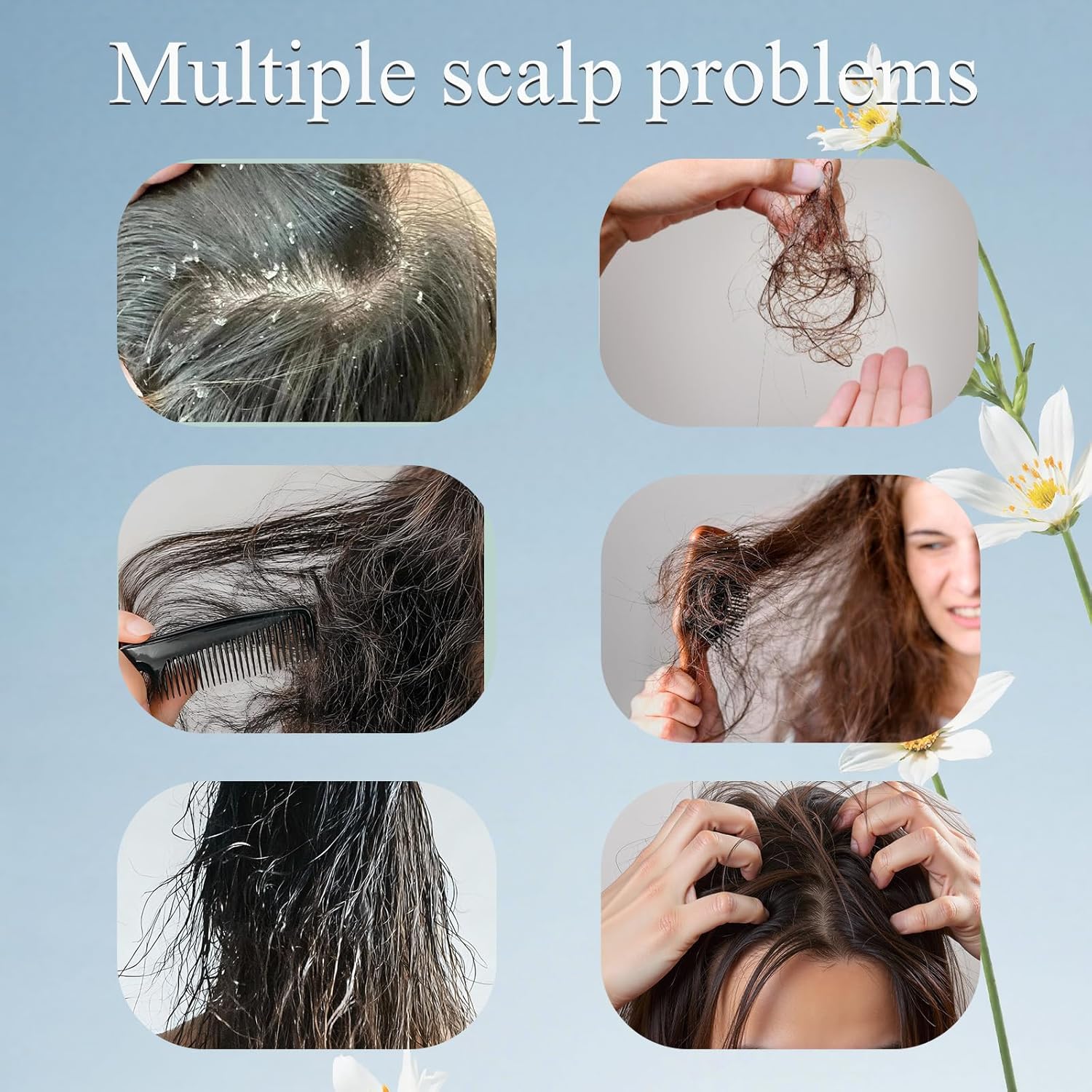 Trichology Shampoo | Anti-Hair Fall & Less Shedding & Volumizing Shampoo | Biotin, Arginine & Oleanolic Acid Strengthens Roots Promotes Hair Growth Oil Control & Scalp Nourishment 300ML (2PCS)