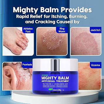 Tobcharm Antifungal Cream with Tea Tree Oil for Ringworm, Jock Itch, Athletes Foot, and Fungal Skin Infections Anti-Fungal Foot Cream for Fast Relief and Healing