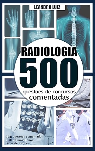 500 Questões de Concursos para Radiologia Comentadas: Questões de Radiologia com Gabaritos (Concurso Radiologia Livro 2)