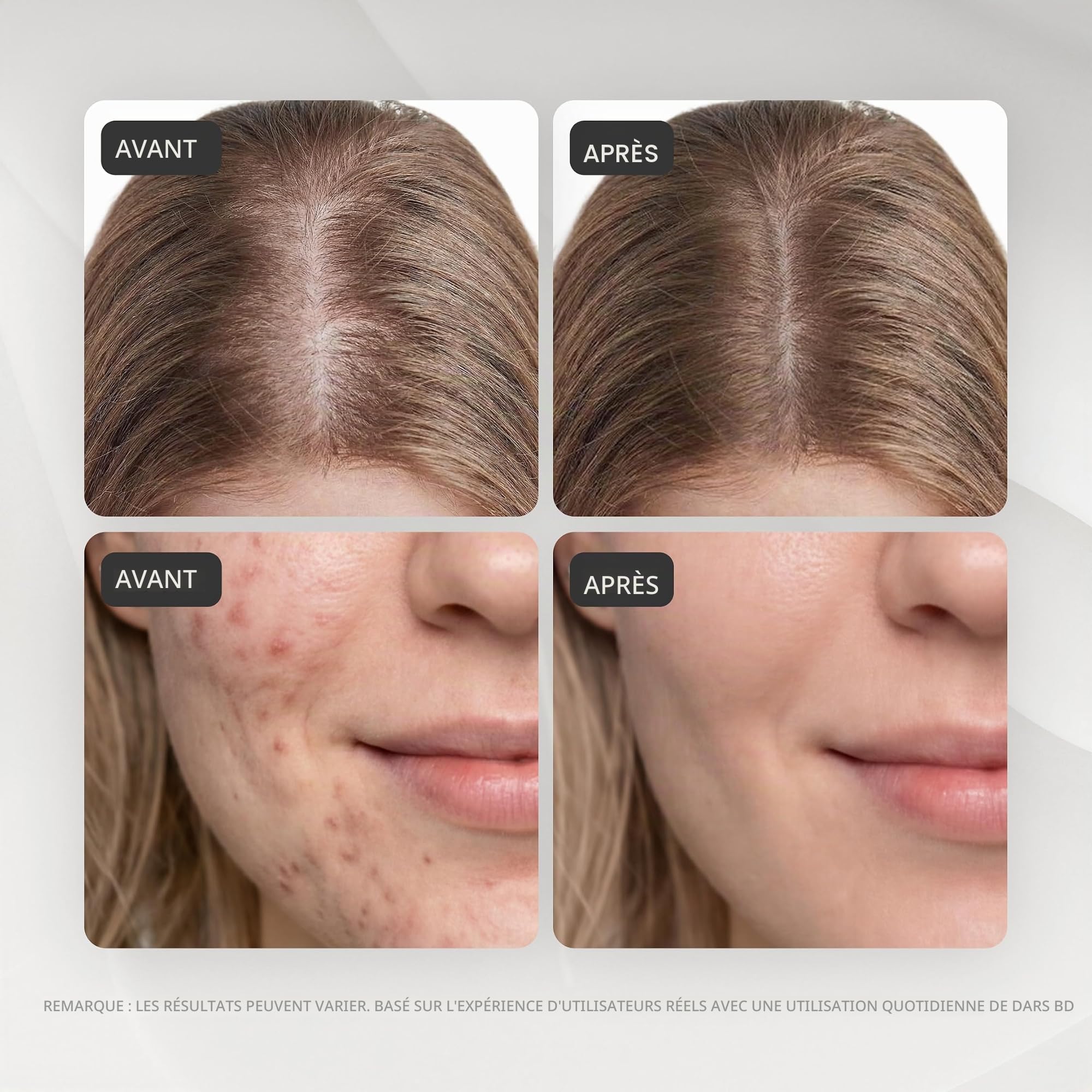 GESS Dars Appareil de Massage Haute Fréquence avec Gaz Argon et Néon, 2 Électrodes pour le Visage et les Cheveux – Barre Haute Fréquence pour le Traitement de l'Acné, Anti-Âge