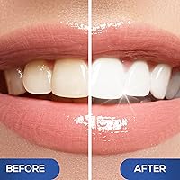 Vista 3 de Venus Visage - Bolígrafo blanqueador dental (2 unidades), más de 20 usos, eficaz e indoloro, no causa sensibilidad, apto para viajes, fácil de usar