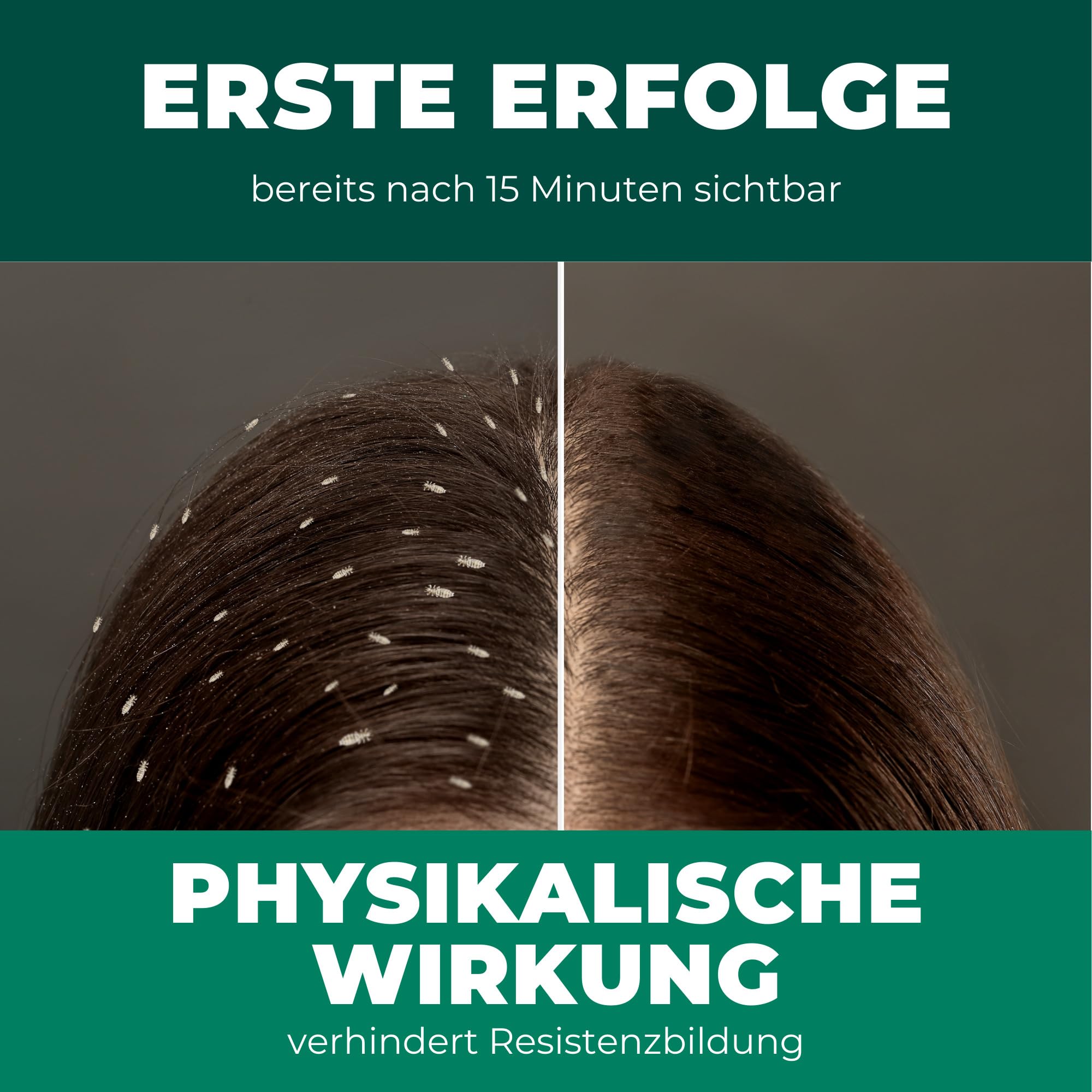Silberkraft Shampoo gegen Läuse und Nissen Family, Medizinprodukt ab 6 Monate, mit Nissenkamm, 15 Min Einwirkzeit, für Kinder & Erwachsene, 100 ml