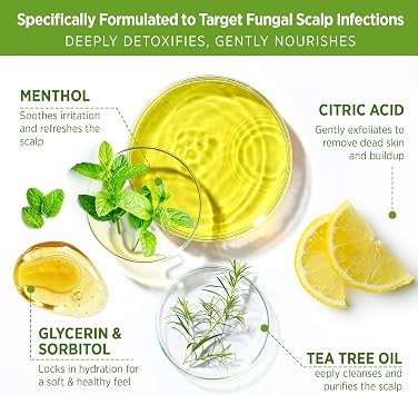 Roycederm Tea Tree Scalp Scrub: Soothing Hair & Scalp Care for Itchy, Dry, Flaky Scalp & Dandruff | Exfoliating & Hydrating with Tea Tree Oil for Women & Men