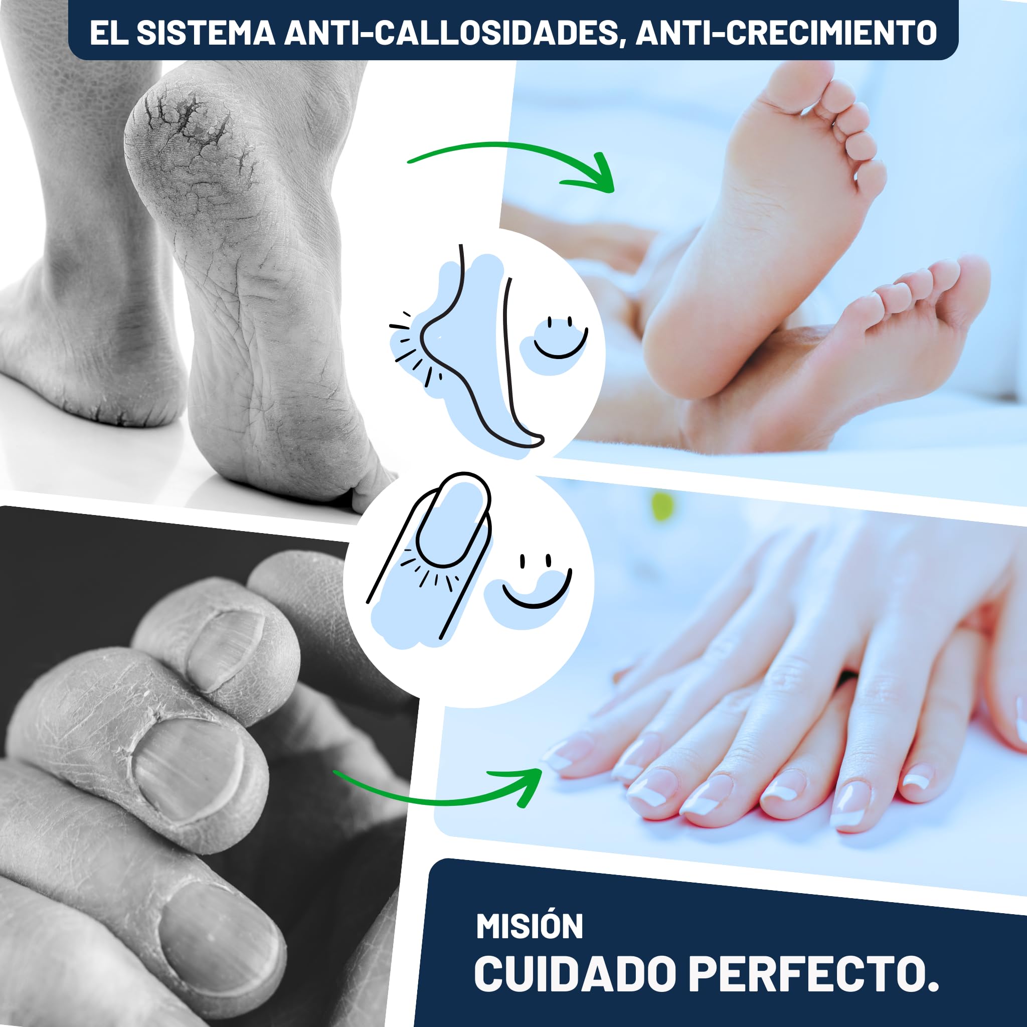 Mr. Fuss® Sistema Anti-Callos, Anti-Crecimiento - Removedor de cutículas Removedor de callosidad - Solución No. 1 - fuertemente ablandamiento
