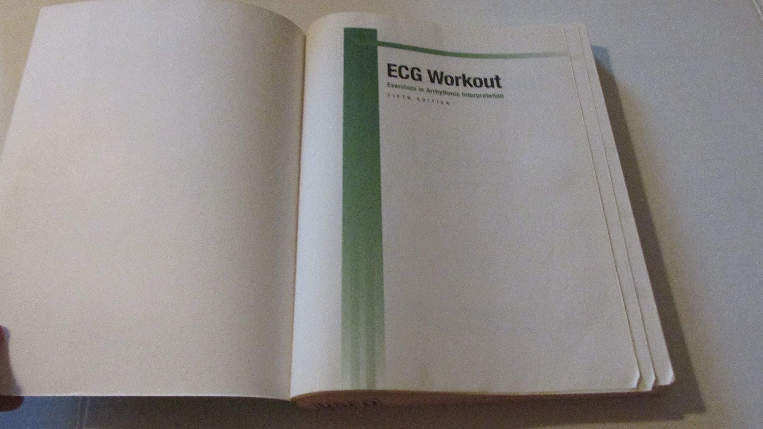 ECG Workout: Learn Heart Rhythm Analysis -2 ECG Workout: Learn Heart Rhythm Analysis -2