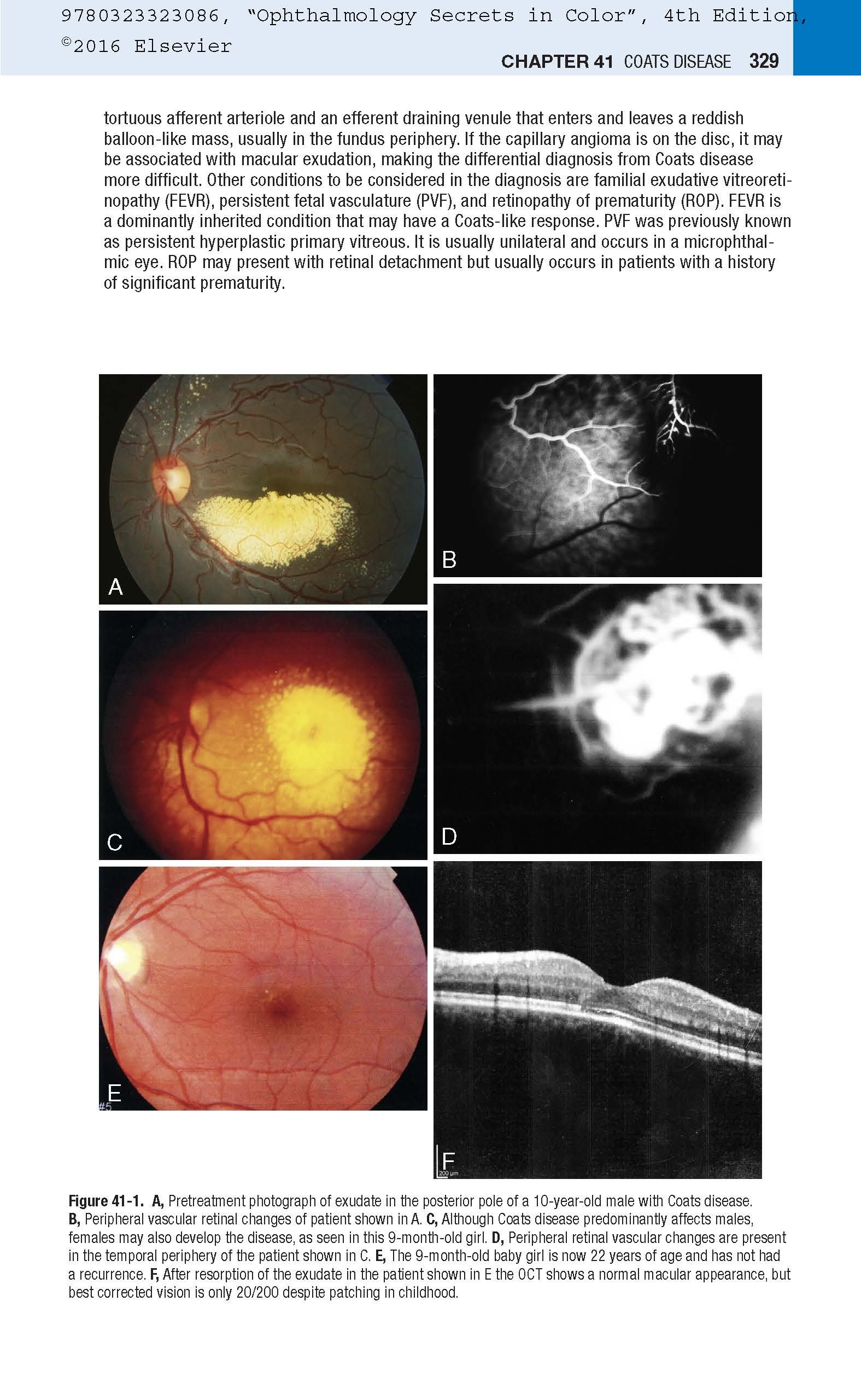Ophthalmology Secrets in Color