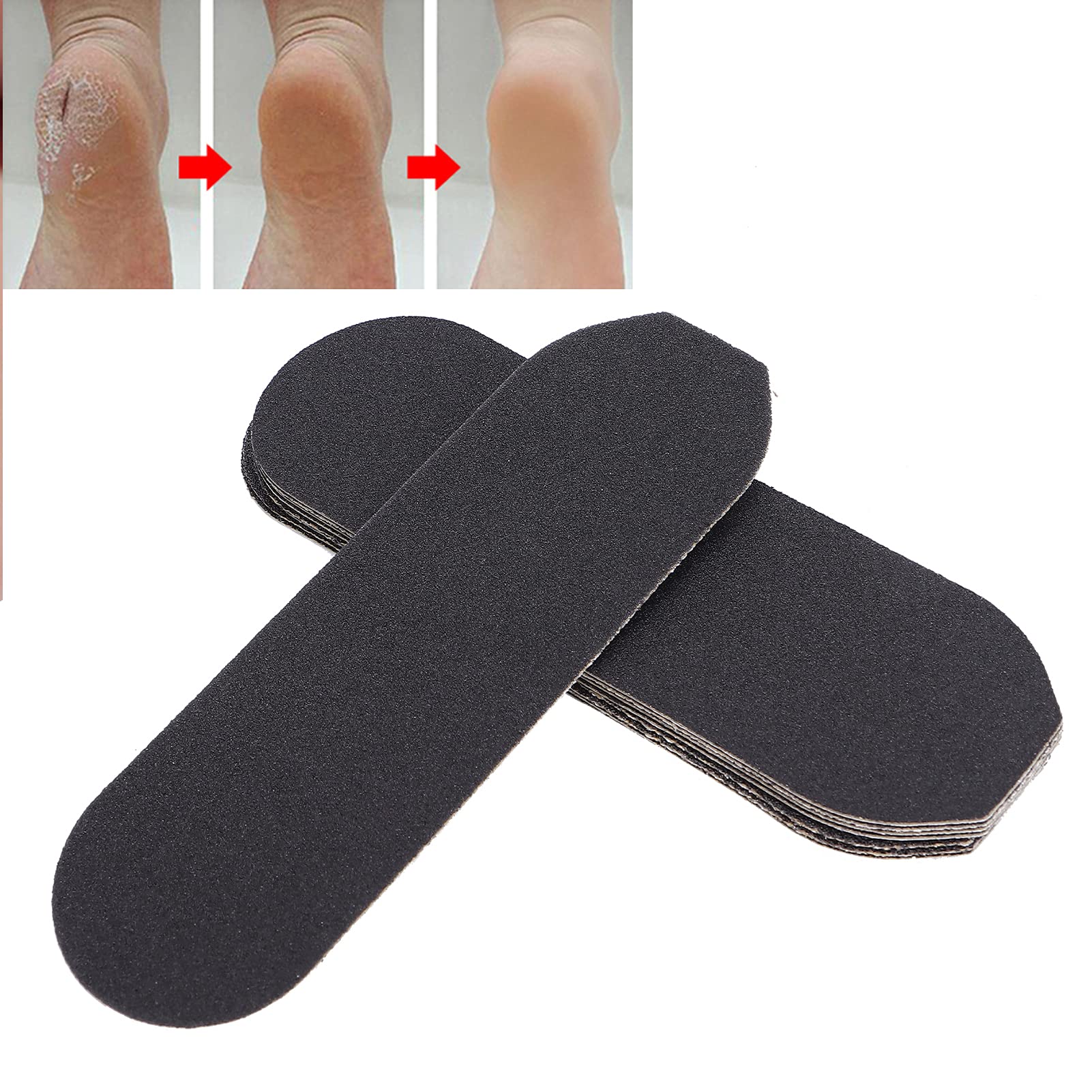 Horoper Pedicure Foot File Refill, 10pcs Replacement Pedicure Rasp Refills, Coarse & Fine, Sandpaper, Stainless Steel Foot File