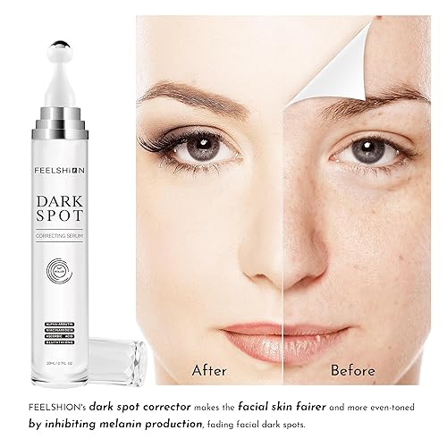 Miniatura 5 de Suero eliminador de manchas oscuras para rostro y cuerpo, vitamina C y -arbutina, corrector facial de manchas oscuras para melasma rebelde, manchas