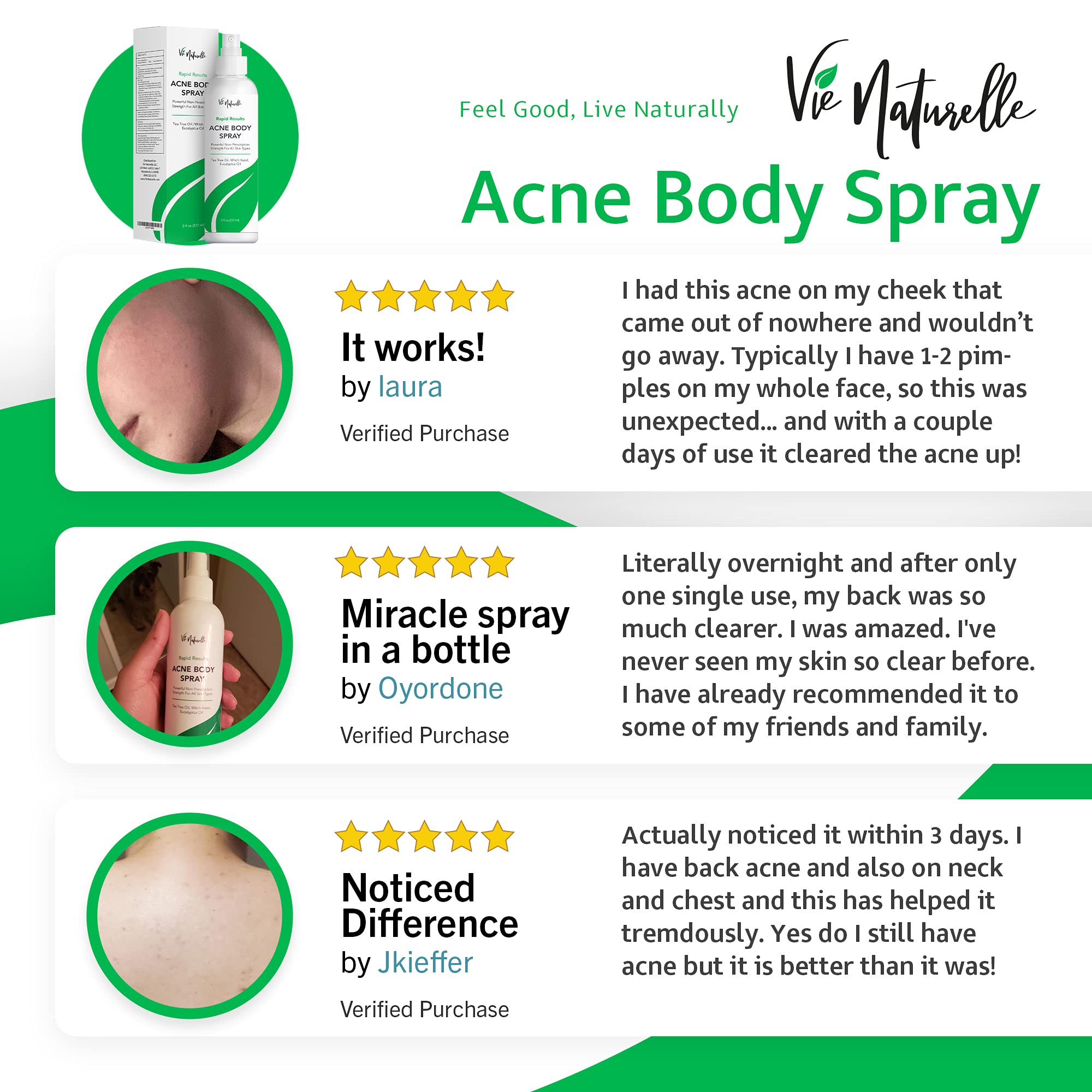 Buy Face, Body Acne Spray with Benzoyl Peroxide Salicylic Acid Butt