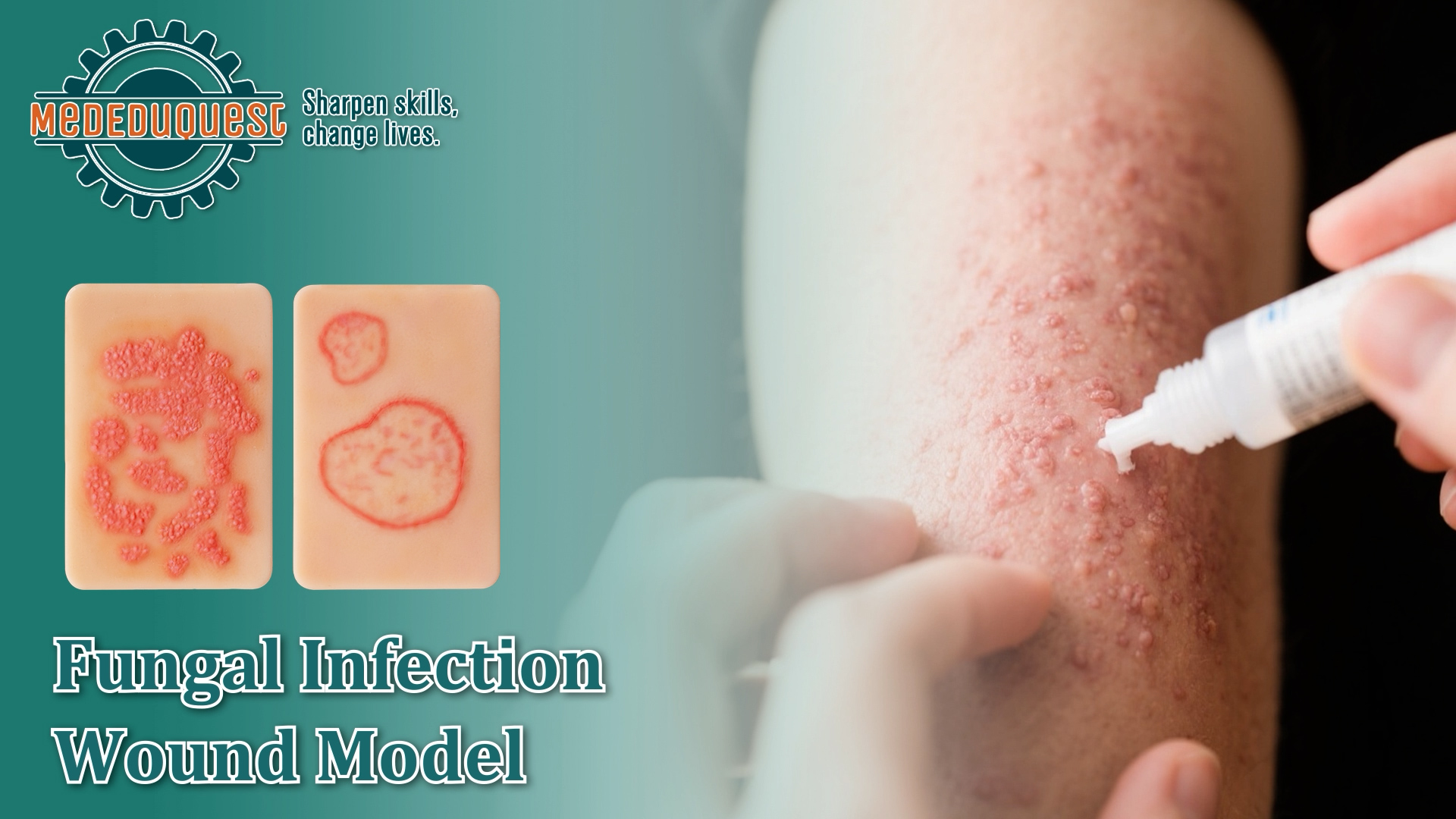 Image of Bacterial Infected Wound Model for Medical Education | Wound Packing Trainer, Palm Sized Wound Simulation Models, Wound Care Demonstrations Tool, 4PCS