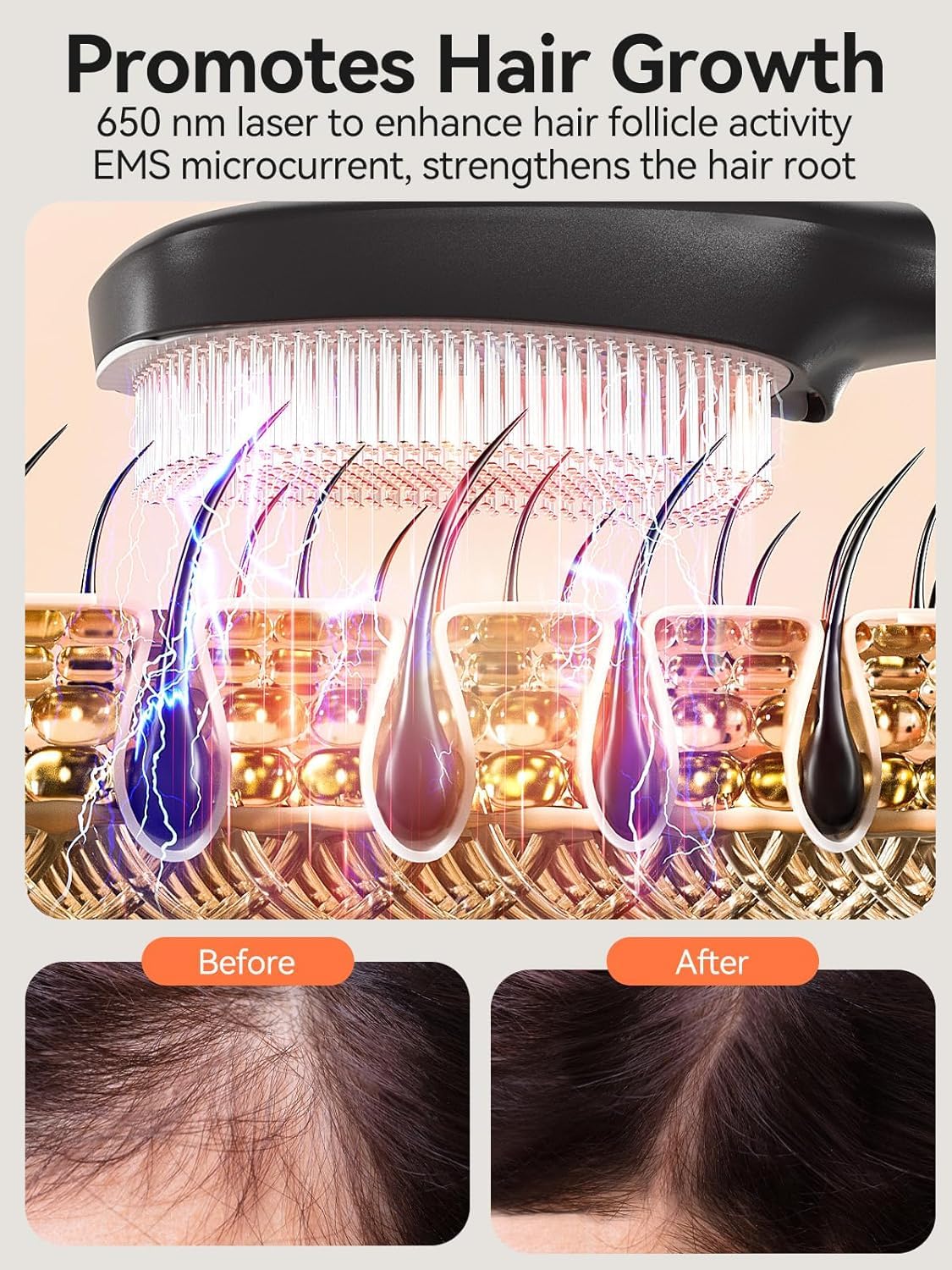 TOUCHBeauty Peine para Crecimiento del Cabello, Cepillo de Masaje 6 en 1 con Luz Roja y Azul para el Cuidado del Cuero Cabelludo, Peine Láser EMS con Iones Negativos para Alisar el Cabello, Recargable