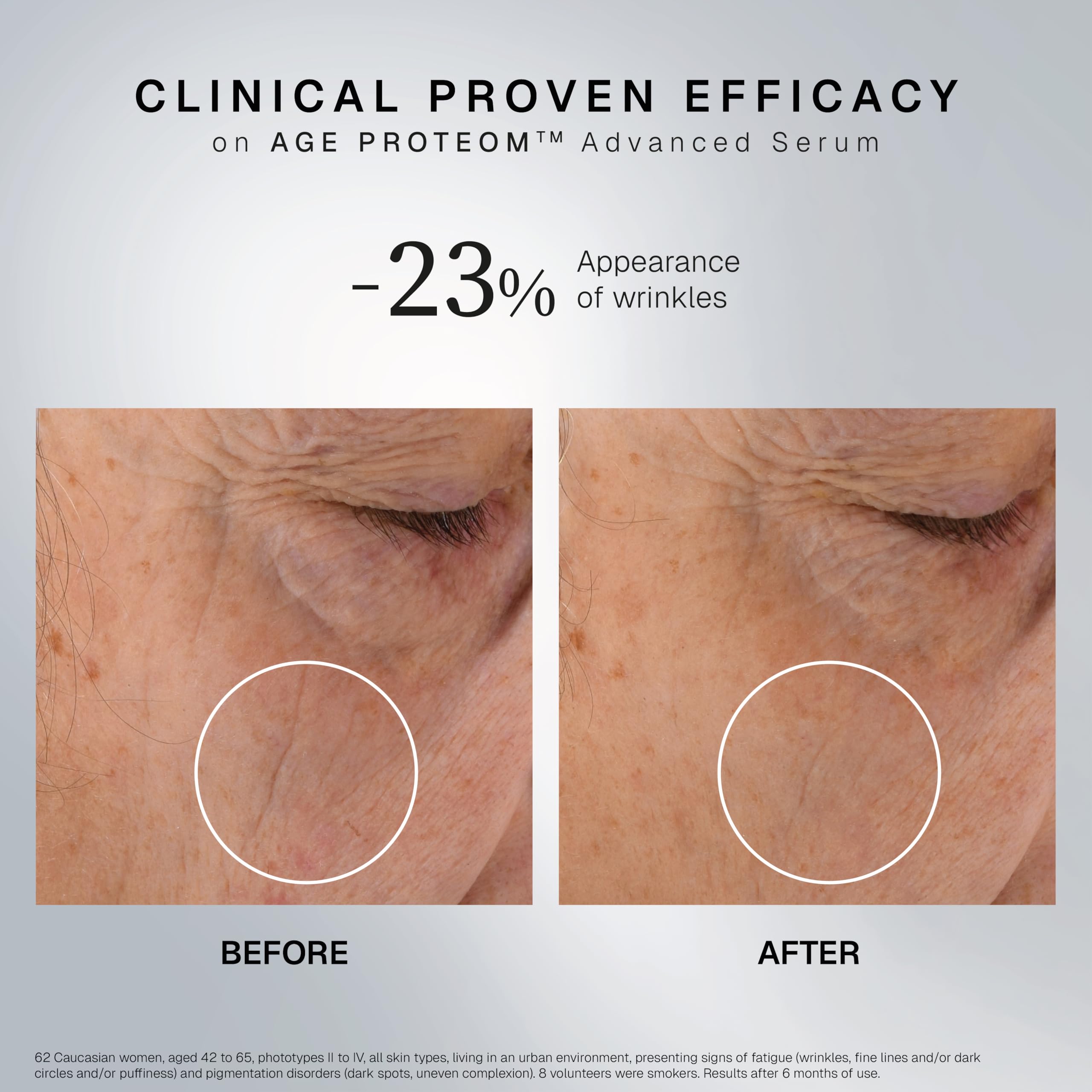 INSTITUT ESTHEDERM Age Proteom Advanced Sérum 30 Ml per chi cerca qualità e praticità, per uso pratico e risultati affidabili, 30 ml