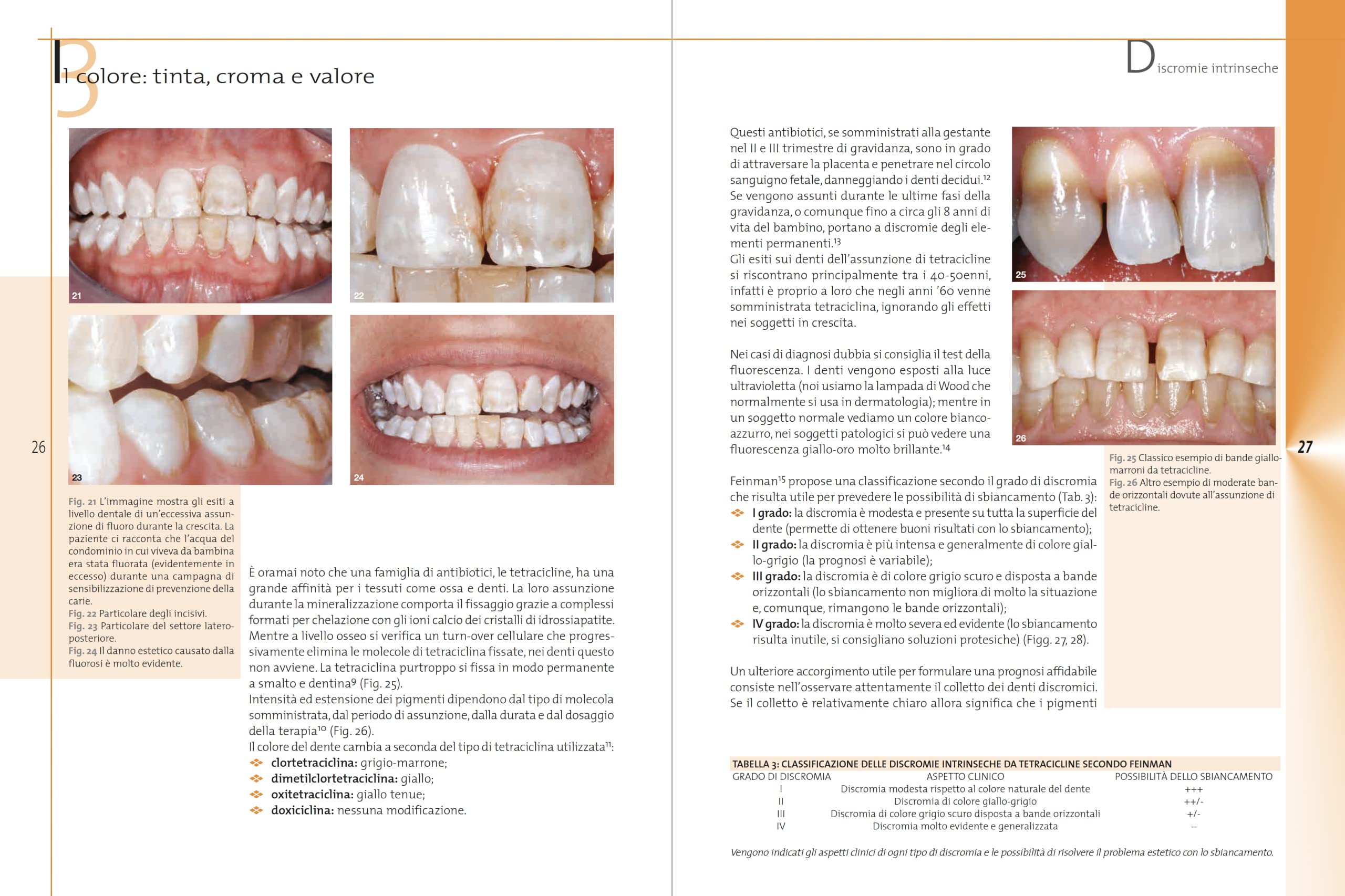 Sbiancamento dentale