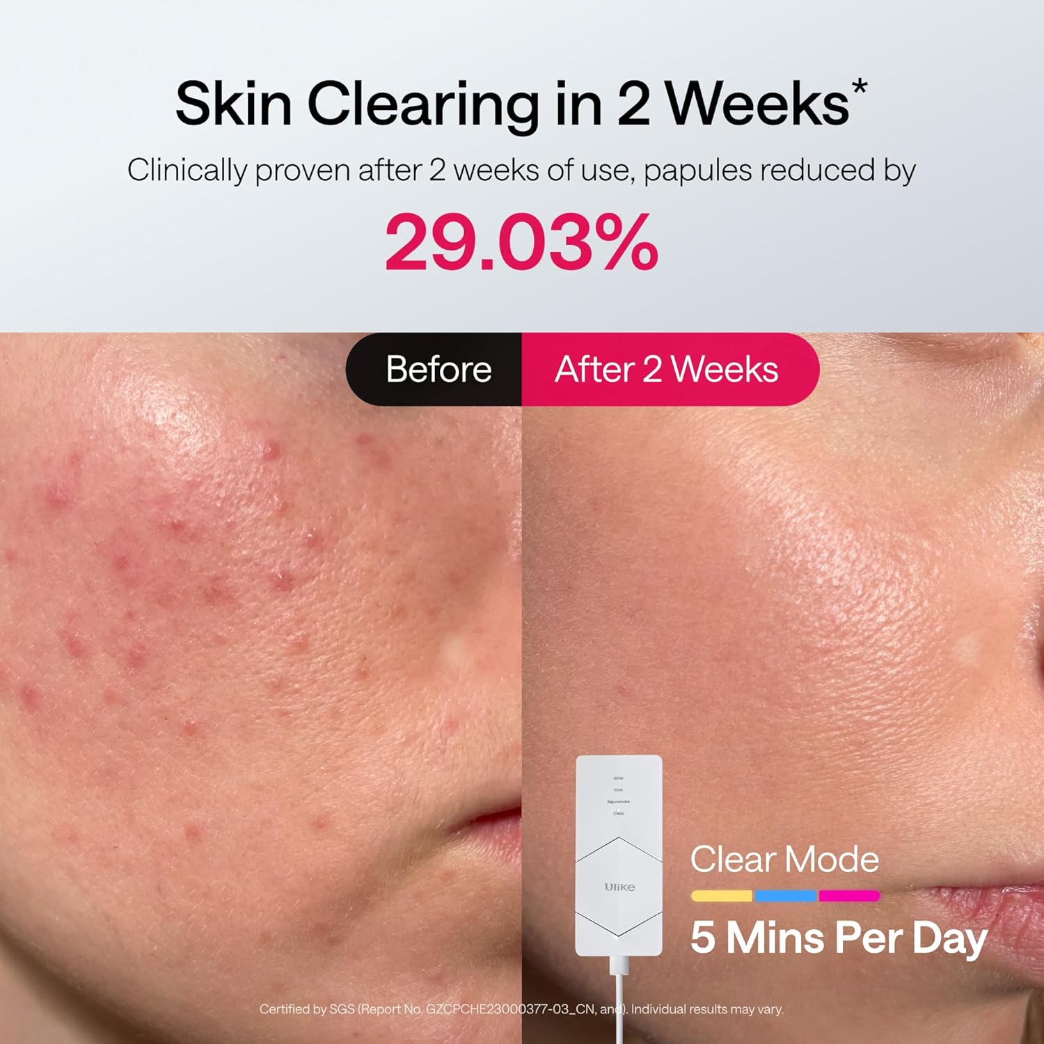 Ulike ReGlow LED Light Therapy Mask, Red Light Therapy for Face, 4 Modes with Red, Blue, Yellow & Infrared Lights for Reduce Acne & Anti-Aging, Eye-Protection, 272 Beads, Remote Control,White - Image 5