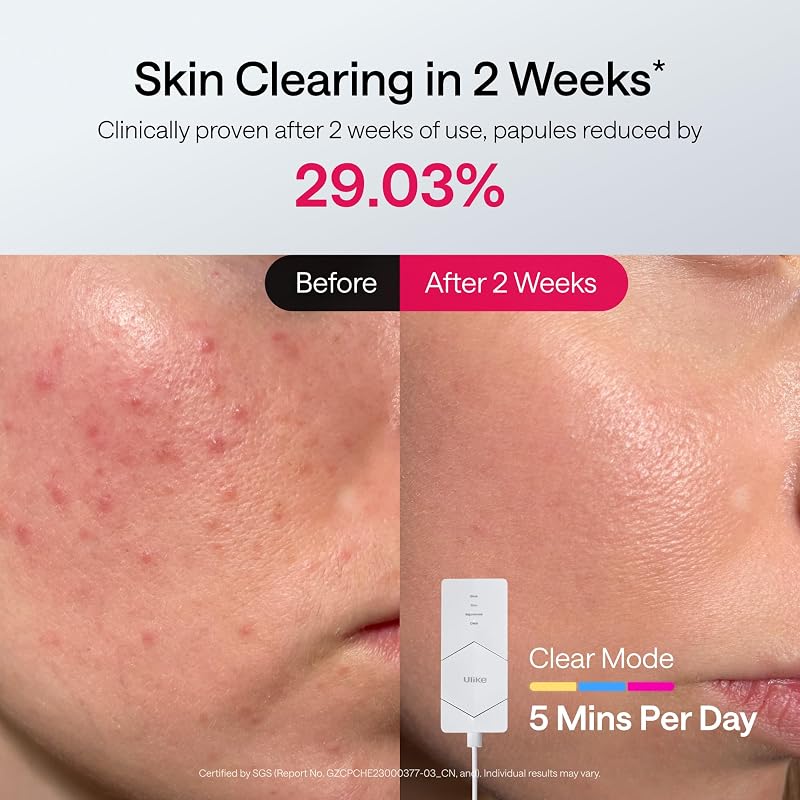 Ulike Red Light Therapy Mask for Face,360° full face coverage image 5