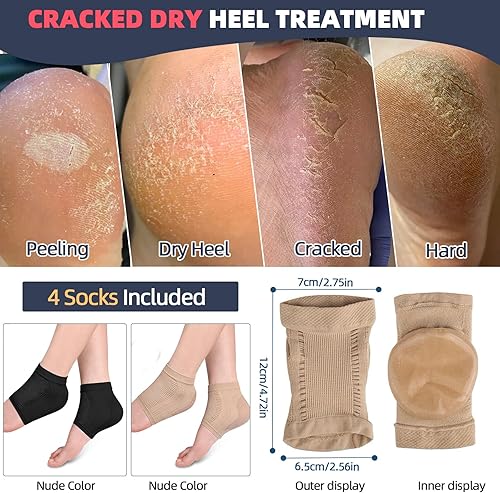 Miniatura 4 de Calcetines de reparación de tratamiento de talón agrietado, 2 pares de mangascalcetines de gel de compresión acolchados de alta calidad para