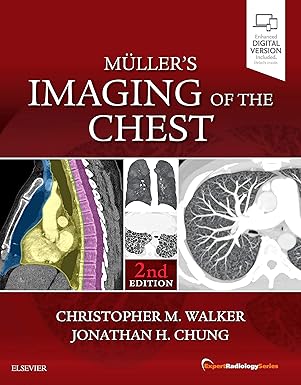 Muller's Imaging of the Chest -2E