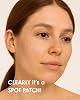 StopEver Clearly Spot Patch, Anti-Acne Transparent Plaster | Transparent, Ultra Thin, Anti-Acne Face Band with Hydrocolloid + Niacinamide + Salicylic Acid Content | 24 Pieces