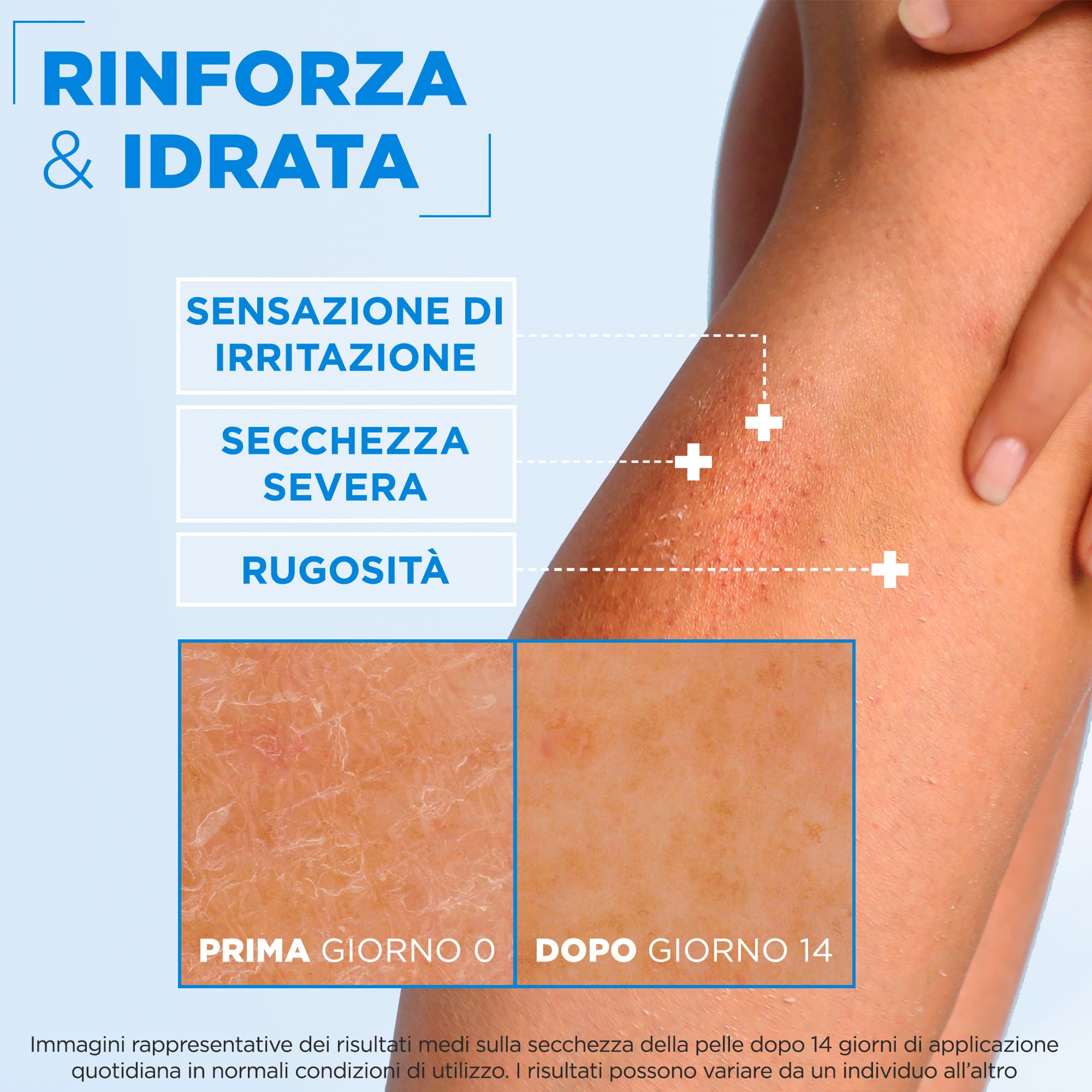 Mixa Crema Idratante Rinforzante, Per Pelli Sensibili e Molto Secche, Pelle Idratata a Fondo, Con il 10% di Ceramidi, Glicerina e Squalano, Senza Profumo, Ceramide Protect, 400 ml