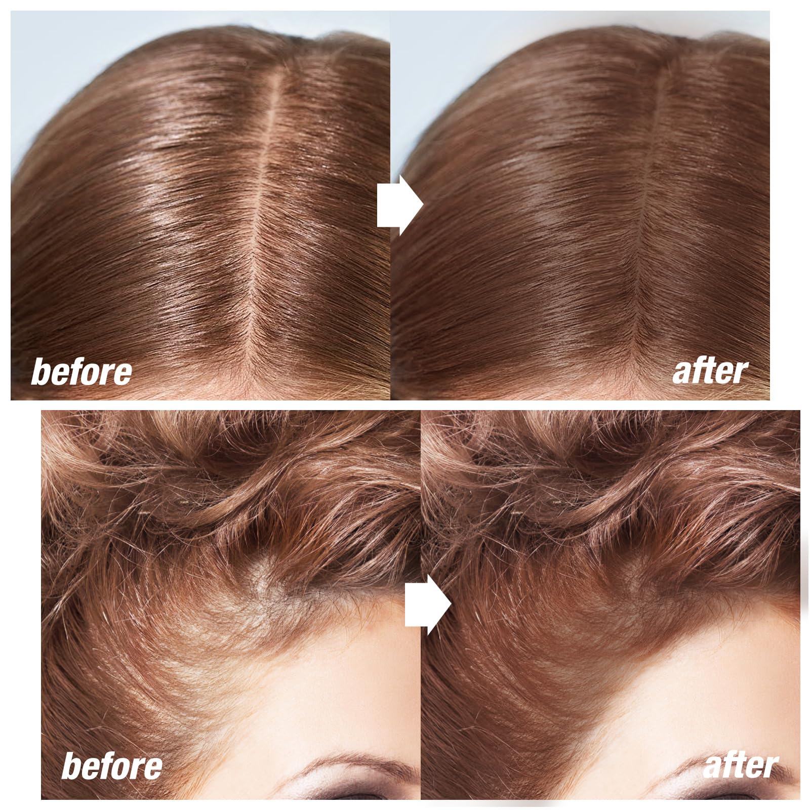 Boobeen Hairline Shadow Stick, Hair Root Concealer & Touch Up Powder With Sponge, Instant Cover Up For Thinning Grey Hair - Image 2