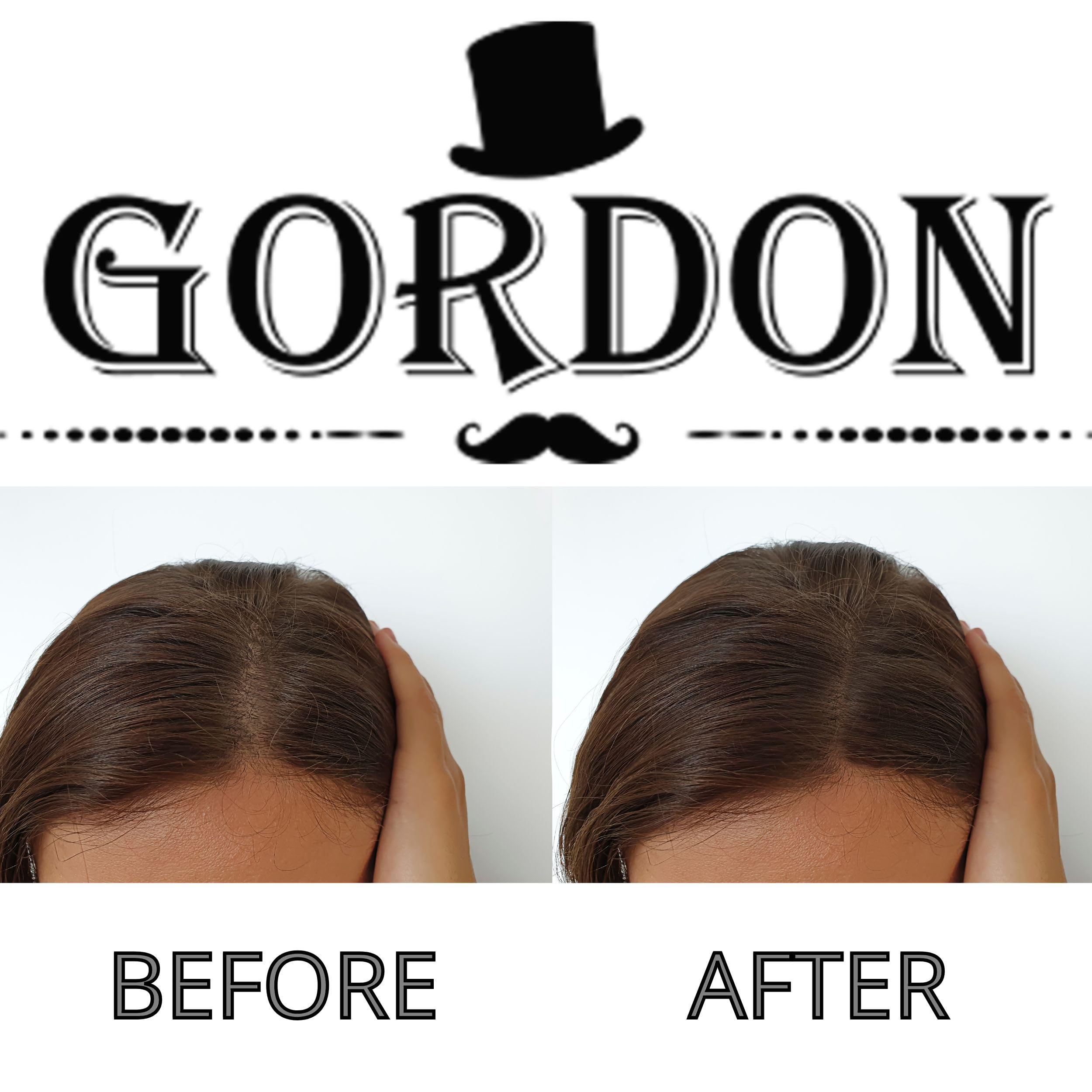 Fibre per capelli Gordon – Ricarica da 25g in busta richiudibile, copertura istantanea per il diradamento. (2 x Castano Scuro - Dark Brown)