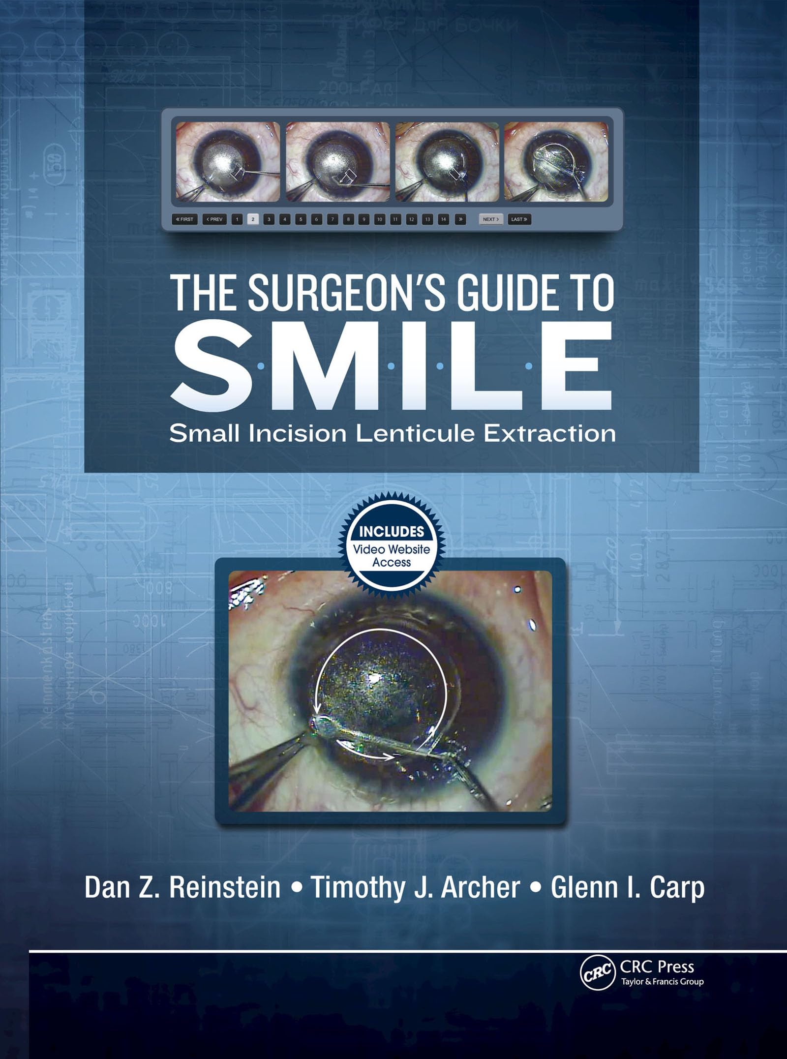The Surgeon’s Guide to SMILE: Small Incision Lenticule Extraction (English Edition)