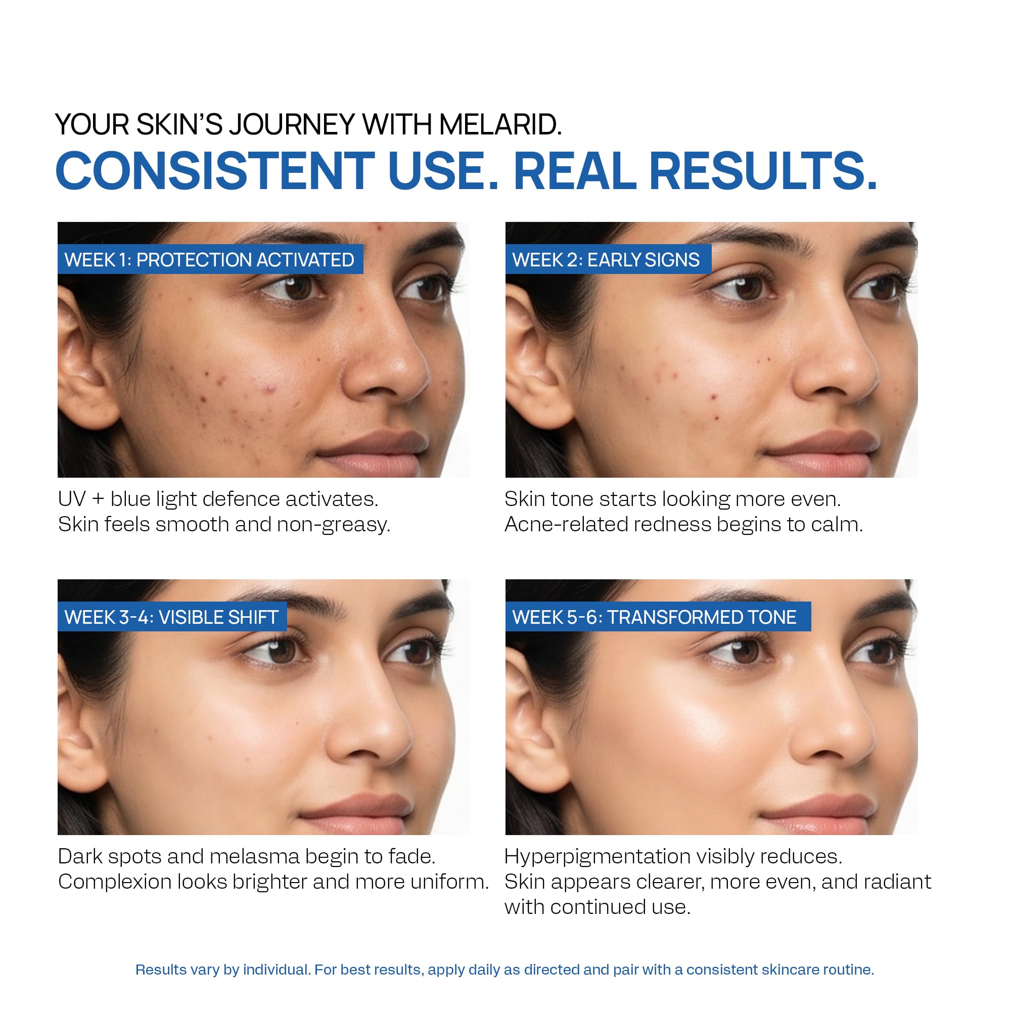 Yuderma Melarid Pigment Corrector Sunscreen SPF 65 PA++++ | Multi spectrum defense UVA, UVB & HEVL Protection | 50 ml 3