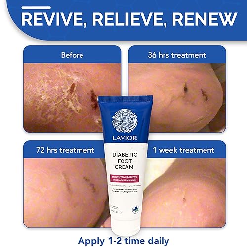 Miniatura 3 de Crema para pies diabéticos - Hidratación y alivio intensivos  Natural y no tóxica  Recomendado por médicos, clínicamente probado  Hipoalergénico,