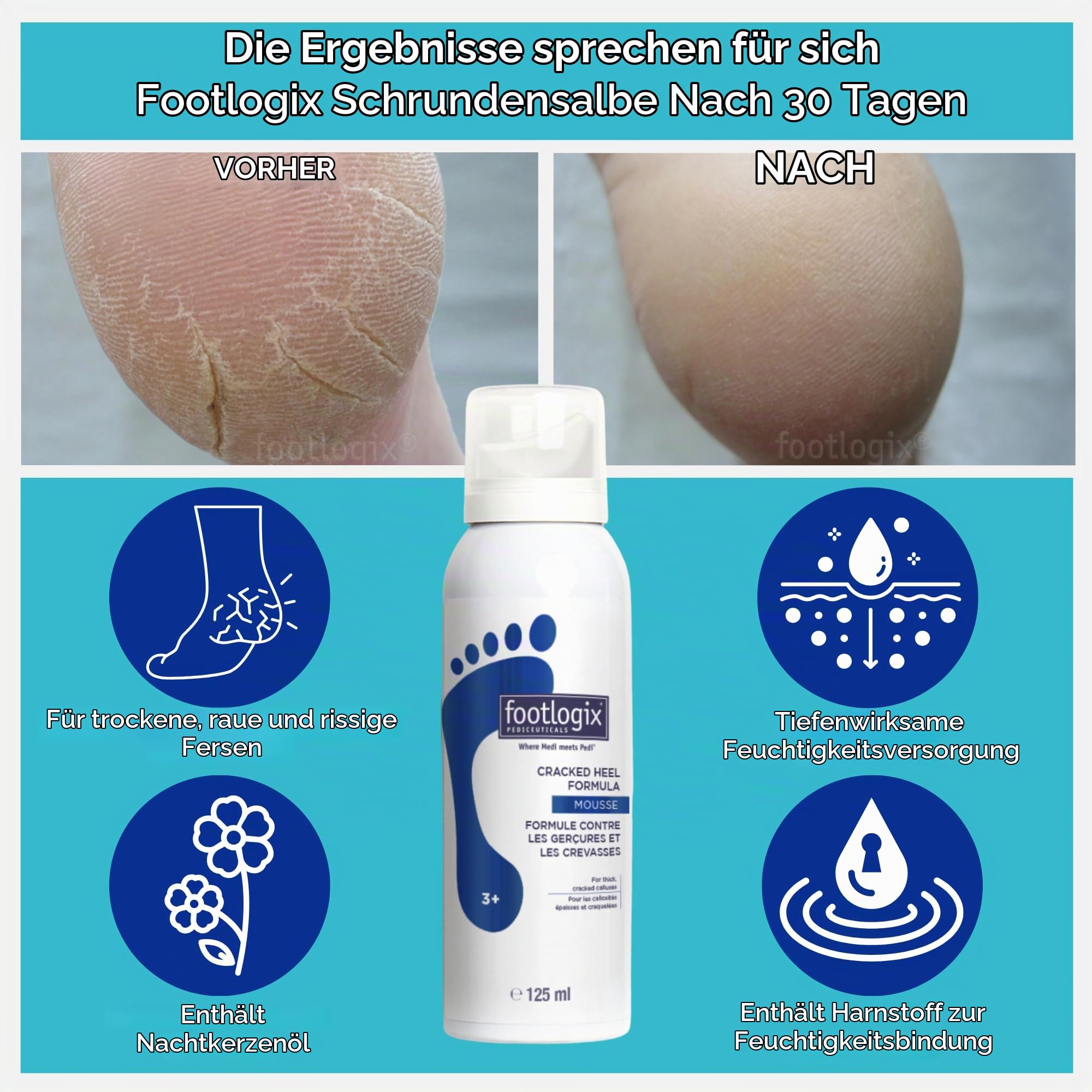 Footlogix Cracked Heel Formula