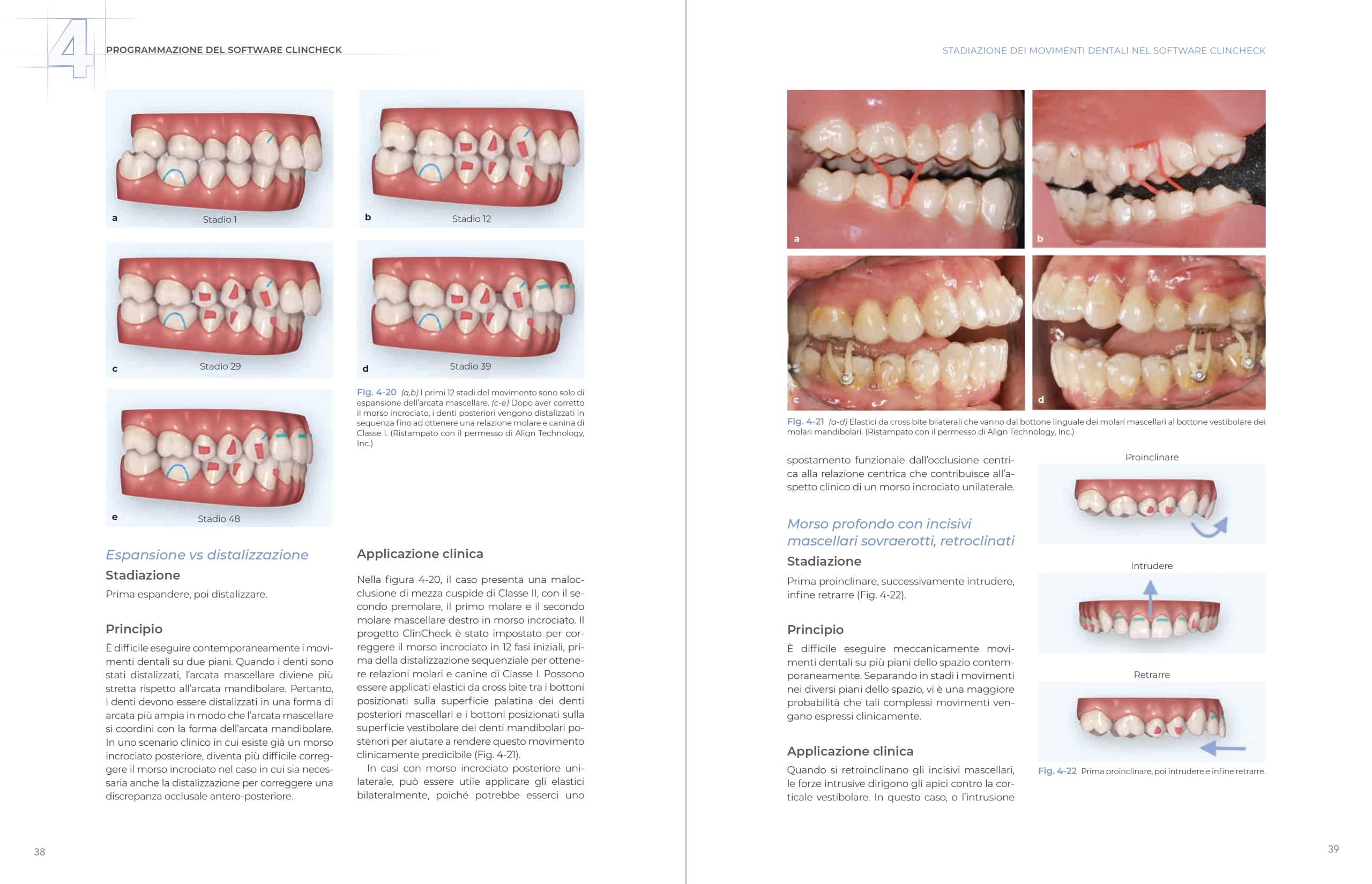 Allineatori trasparenti. Biomeccanica e gestione clinica