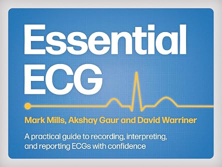 Essential ECG A practical guide to recording, interpreting, and reporting ECGs with confidence