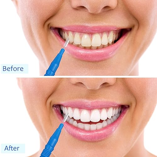 Miniatura 40 de BBTO 100 piezas de llaves de cepillo dental para limpiador interdental, palillo de dientes, cabezal de hilo dental, limpiador oral de palillos Rojo