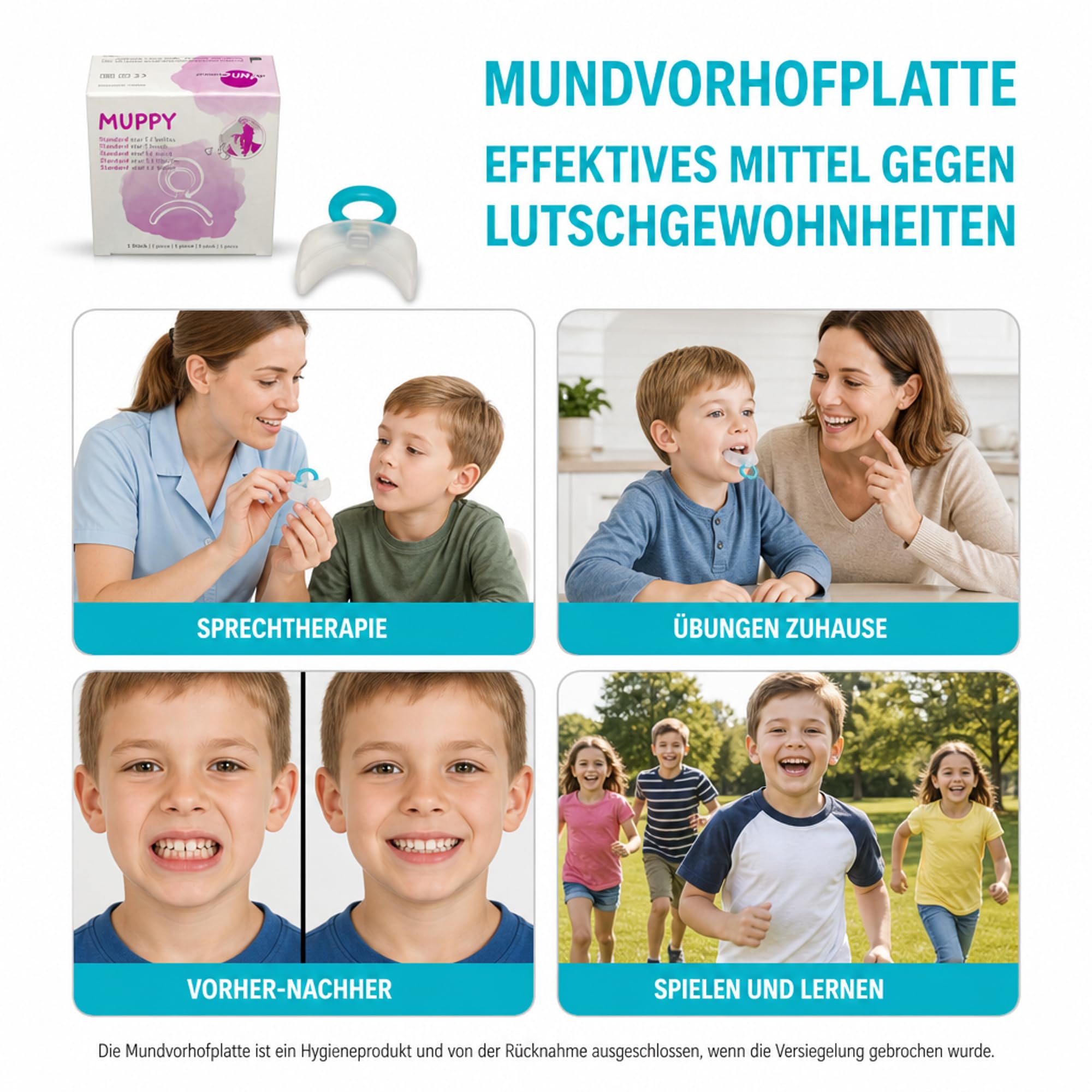 Mundvorhofplatte Standard, klein, transparent/elastisch – Hilft Lutschgewohnheiten abzugewöhnen – Vinylgruppenhaltiges Polymethylsiloxan
