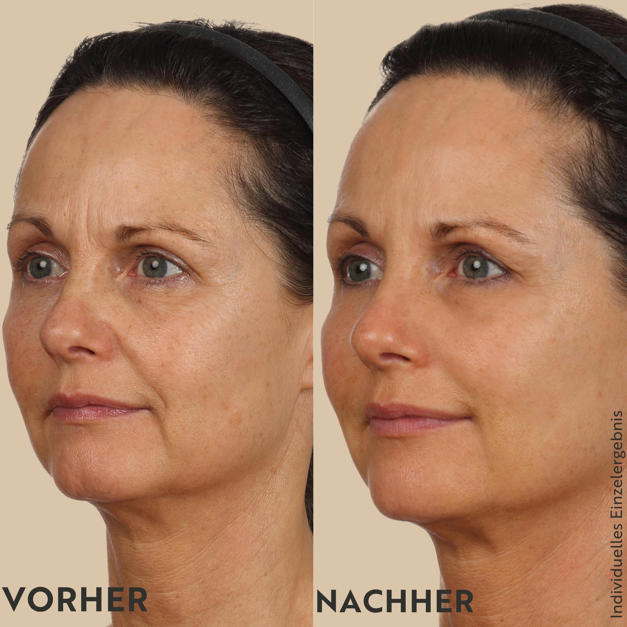 M. Asam Resveratrol Premium NT50 Perfecting Glättungsmaske (50ml)