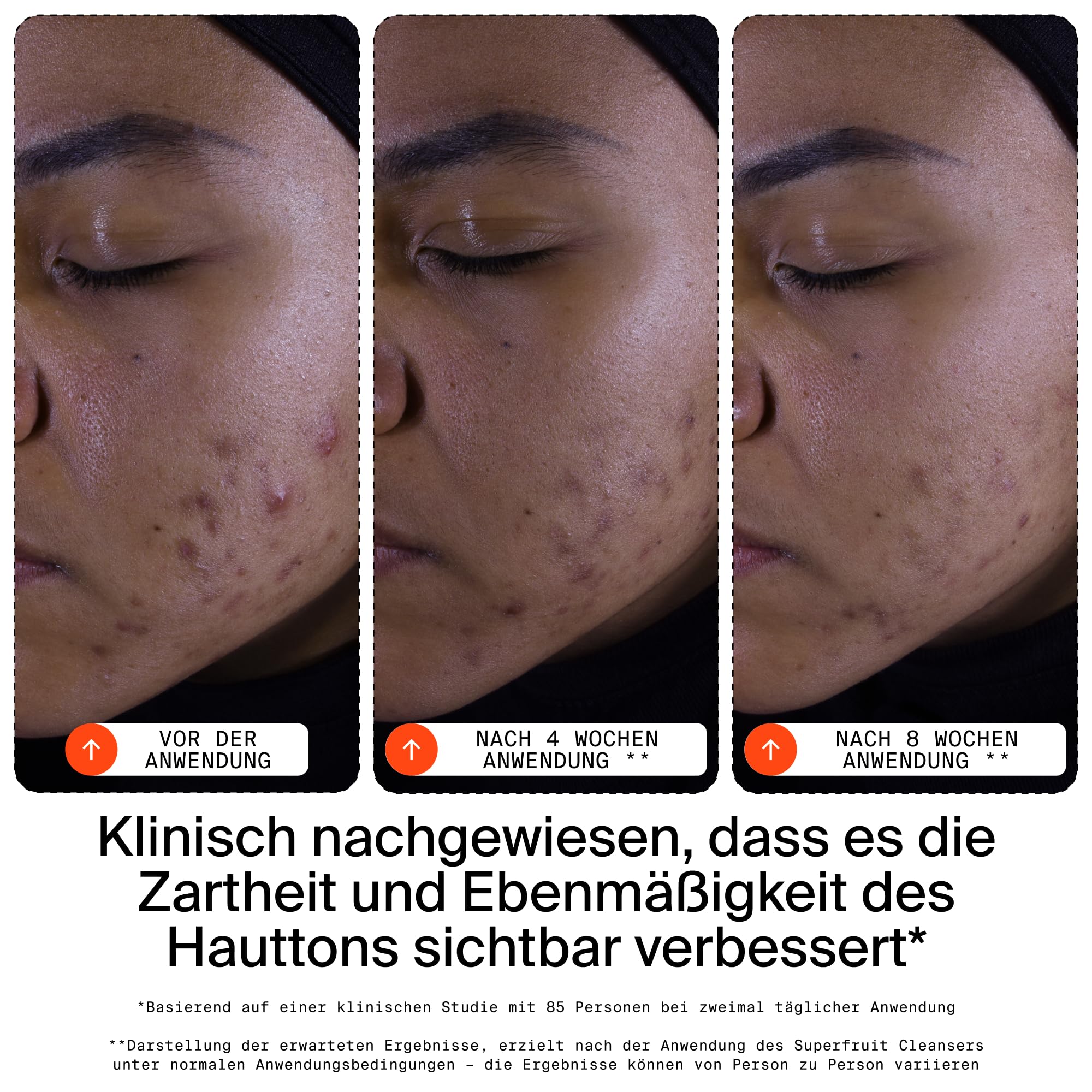 Youth To The People Superfruit Cleanser, sanfter Peeling-Gesichtsreiniger, mit Papaya und Vitamin C, beruhigender Reiniger, feuchtigkeitsspendend, schont die Hautbarriere, Make-up-Entferner