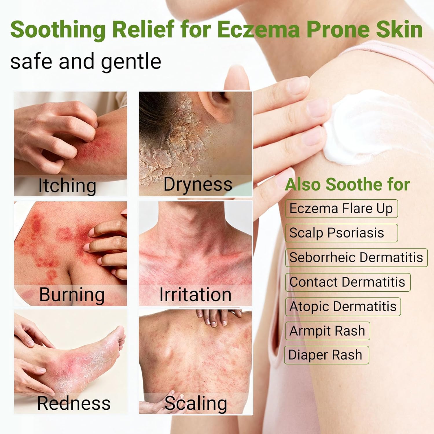 Eczema Cream, Psoriasis, Dermatitis & Rashes Treatment, Moisturizer for Dry, Itchy & Sensitive Skin, Face, Scalp & Body Soothing, Eczema Itch Relief, 3.53 OZ - Image 4