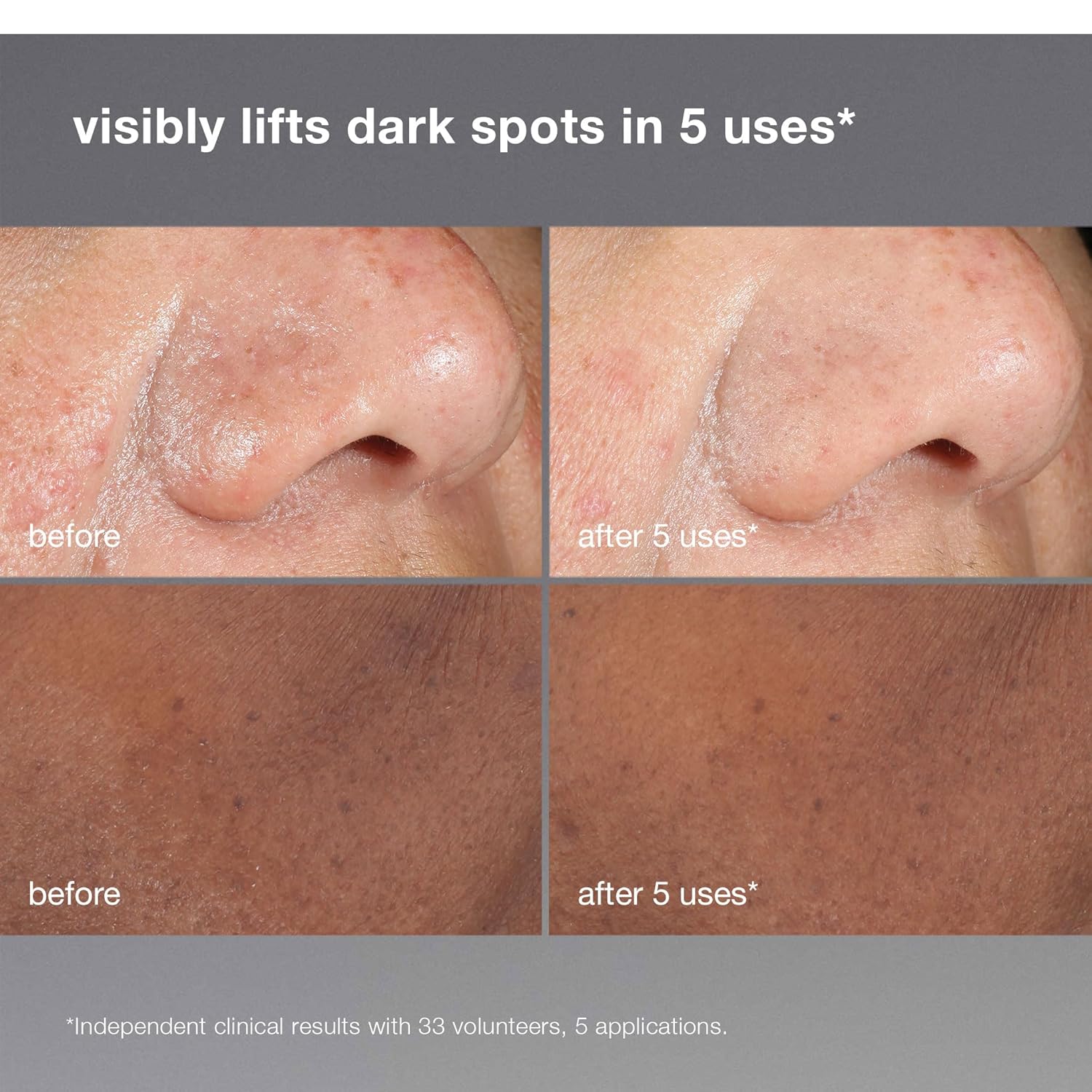 Dermalogica PowerBright Dark Spot Face Peel, Exfoliating Facial Peel with 12% AHA PHA, Improve Dark Spot and Hyperpigmentation for All Skin Types - Image 6