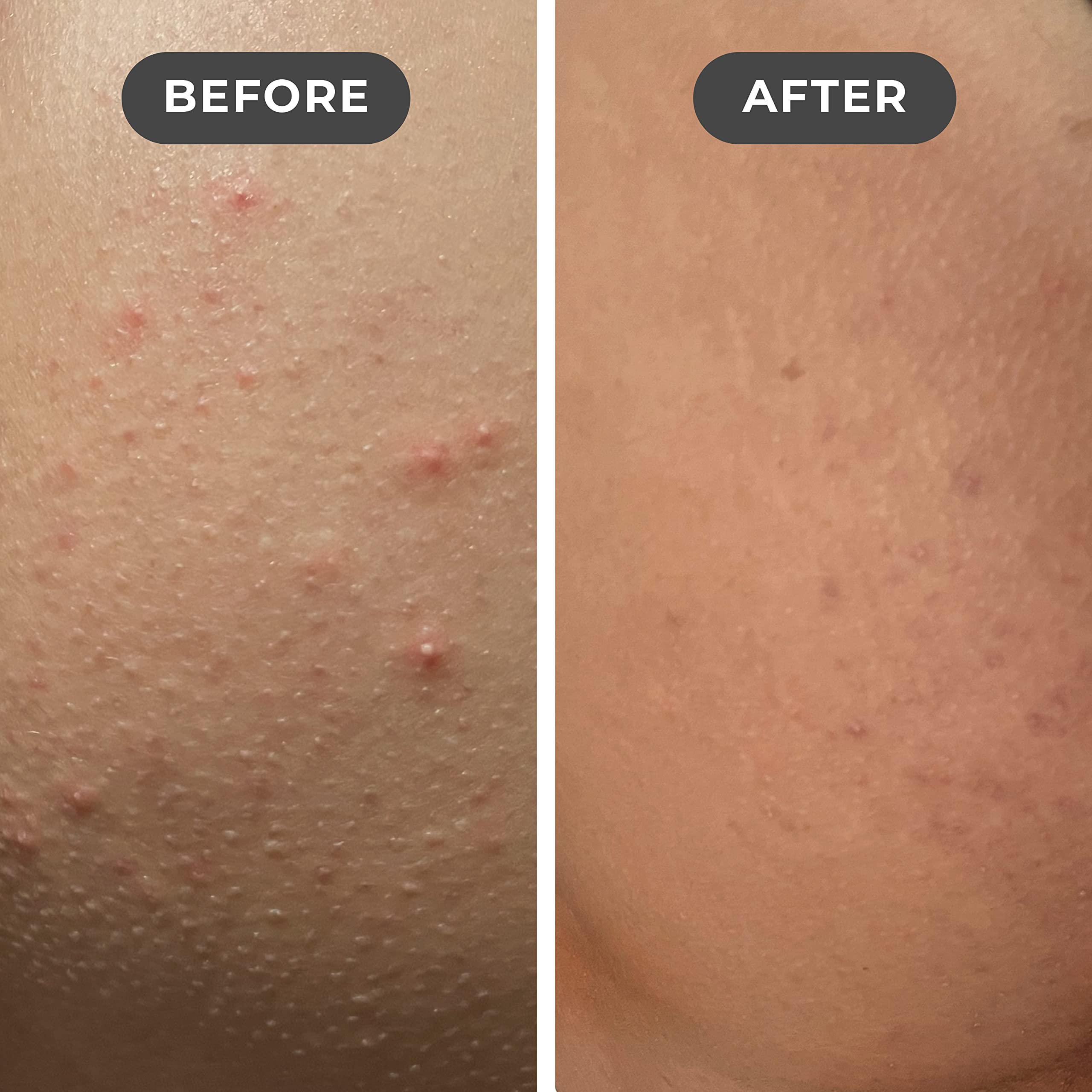 Buy Miami Beach Bum, Bum + Body Cream, Daily Moisturizer to Clear Body