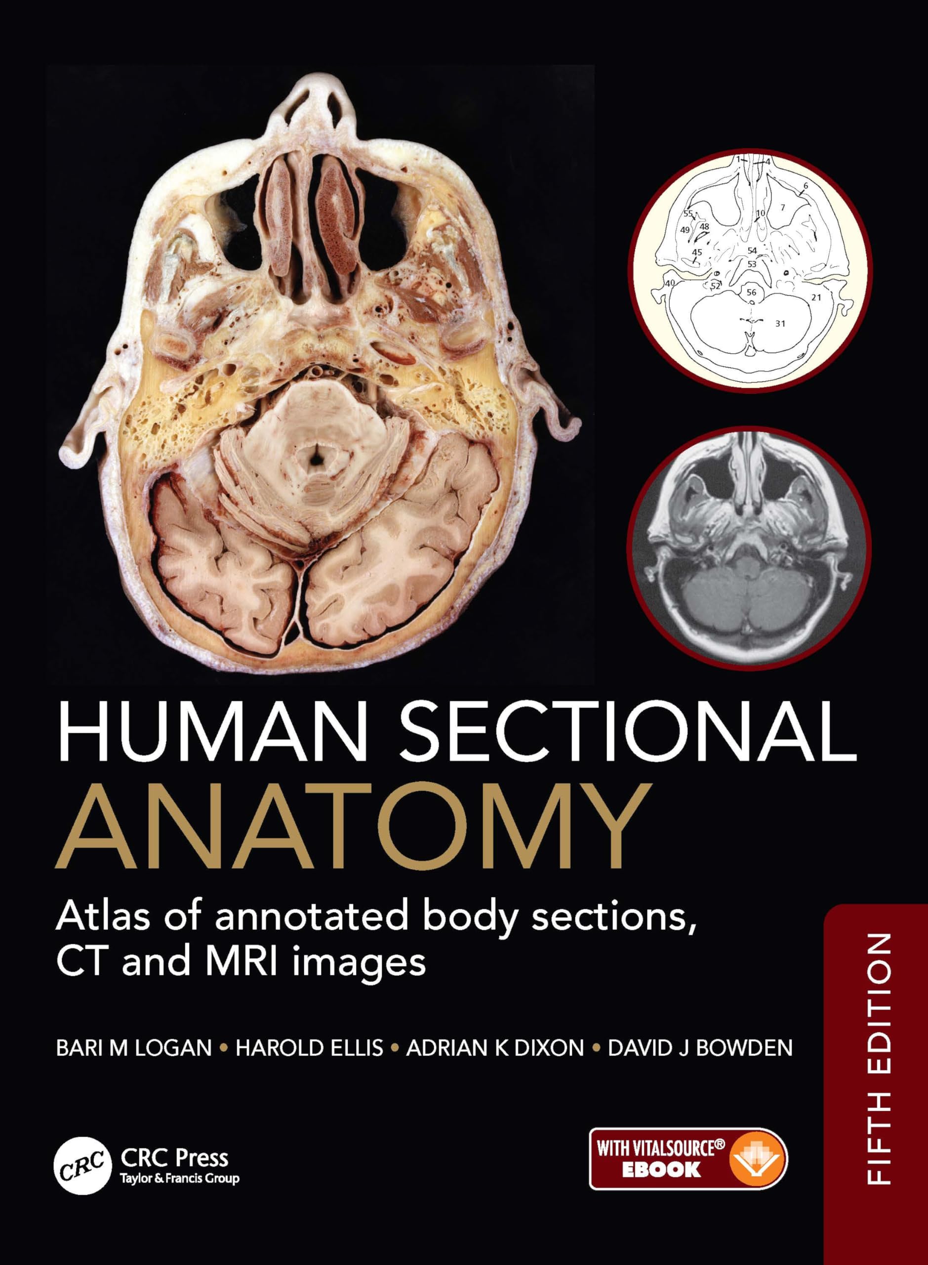 犬の断層解剖と画像Atlas of Imaging Anatomy of the Buy HUMAN SECTIONAL ANATOMY ATLAS OF ANNOTATED BODY SECTIONS CT